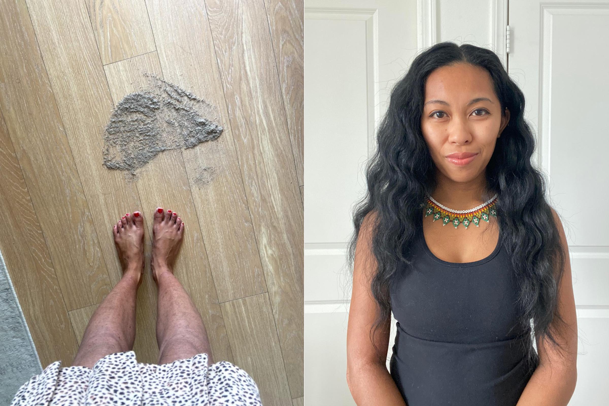 Cassie’s legs with shed skin in a pile on the floor during topical steroid withdrawal beside a recent portrait of Cassie with clear skin.