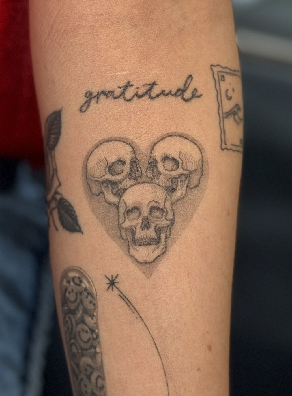 healed skulls ~3 years