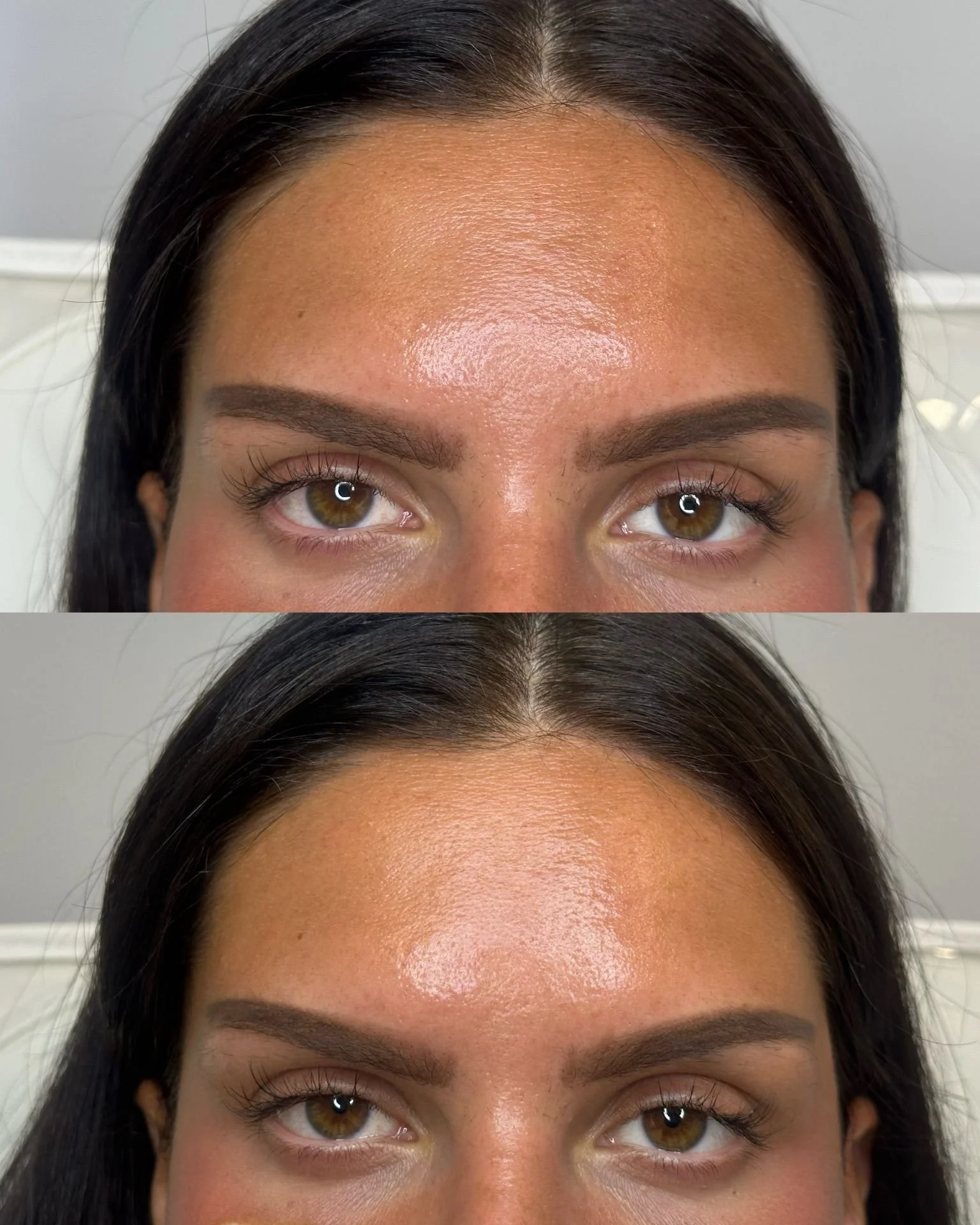 temple_filler_before_after.JPG