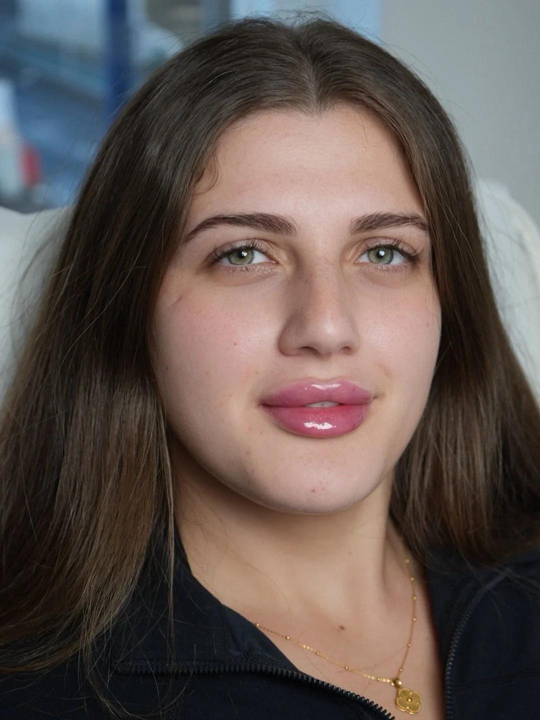 Just a subtle refresh 💋 A small top-up to maintain her gorgeous, naturally plump look - session number 4 and still flawless.

#lips #lipfiller