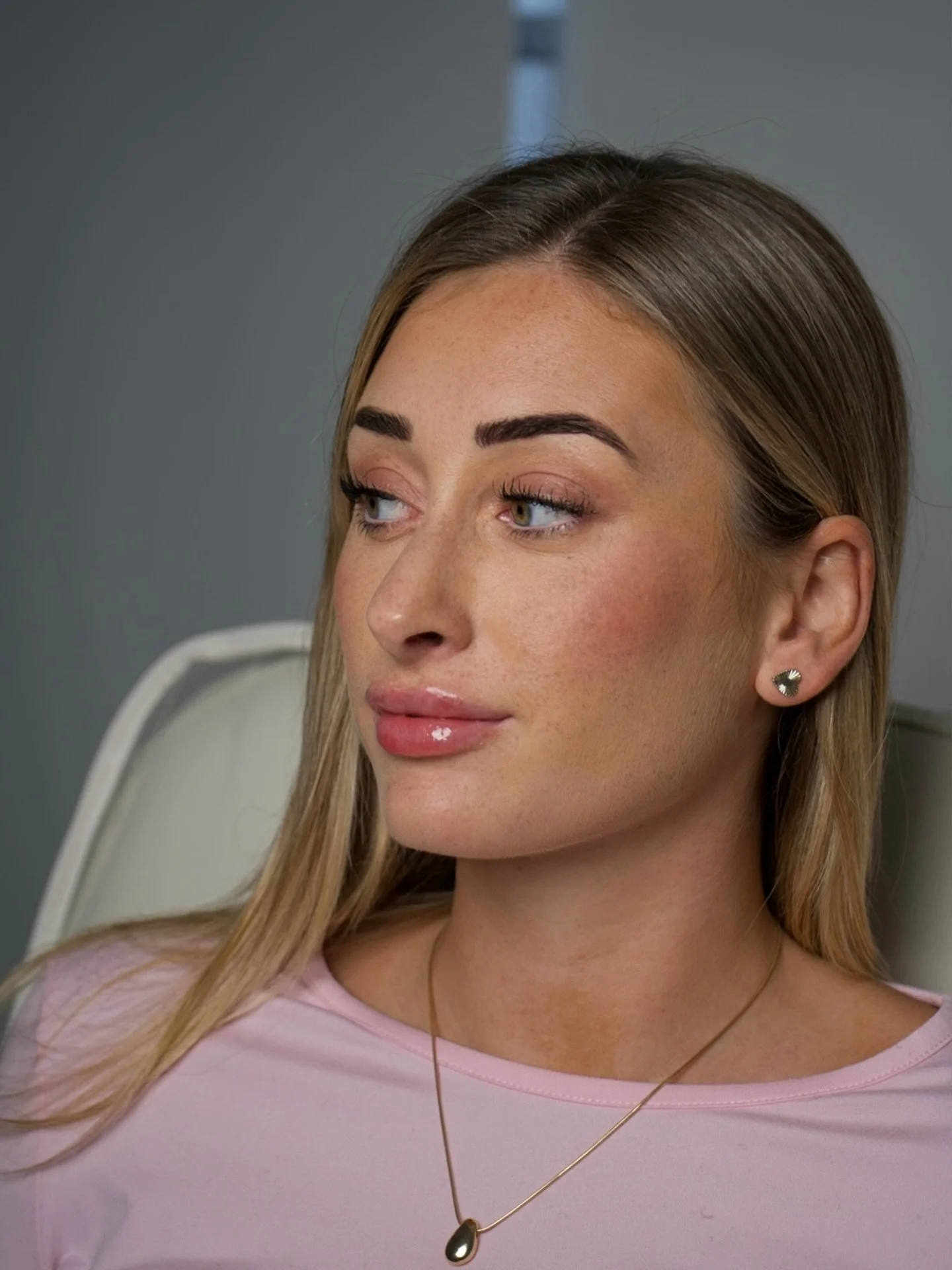 0.5ml lip enhancement 👄

#lips #lipfiller