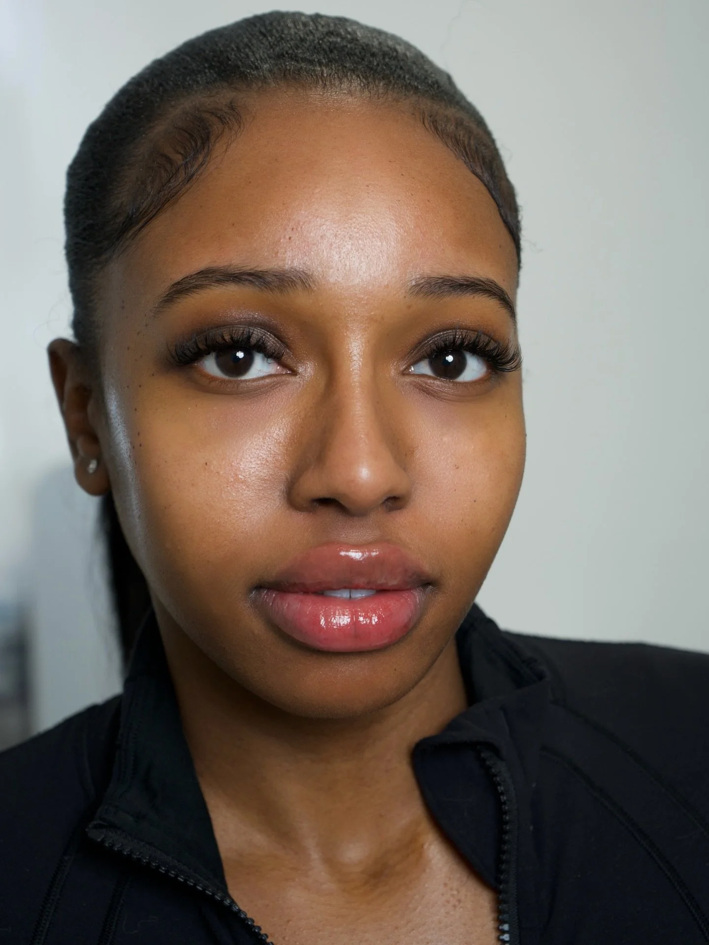 A 0.5ml top-up treatment designed to refine shape, improve symmetry, and enhance natural volume - perfect for maintaining results without overcorrection.

@casaraclinic