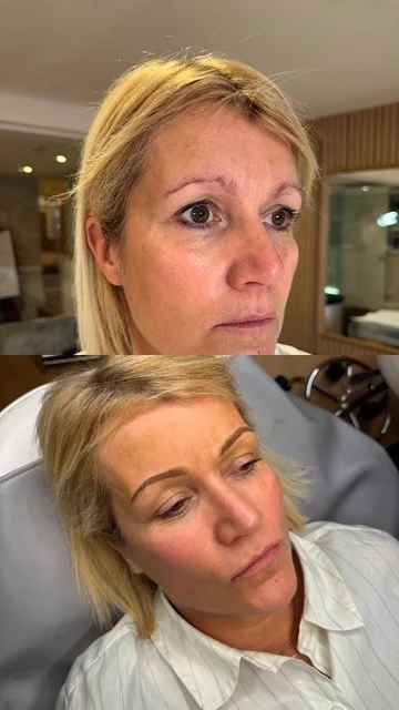 A woman with blonde hair and a serious expression sits in a medical or spa setting, with her eyes closed, and another woman with similar hair and makeup attends to her.