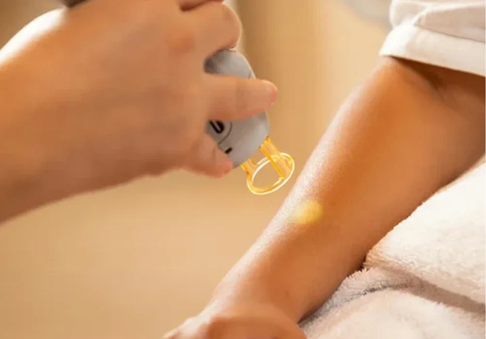 Remove Unwanted Ink with Laser Tattoo Removal image