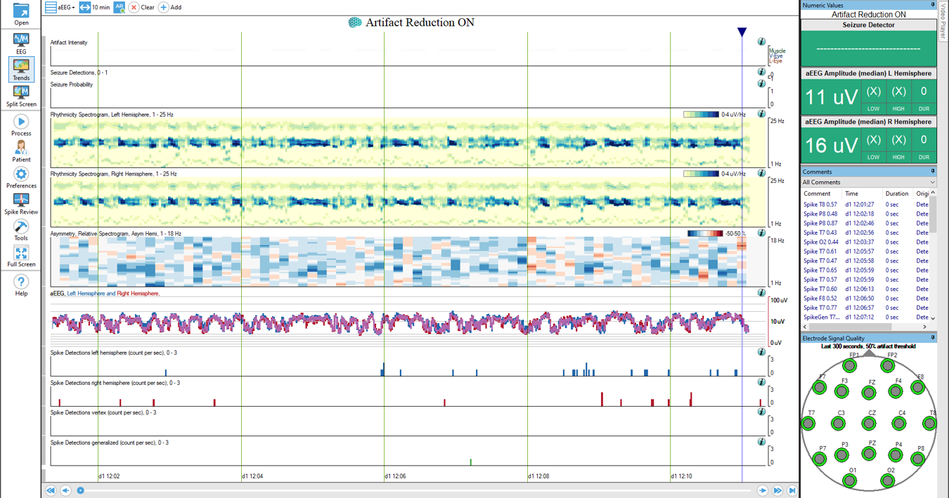spike analysis