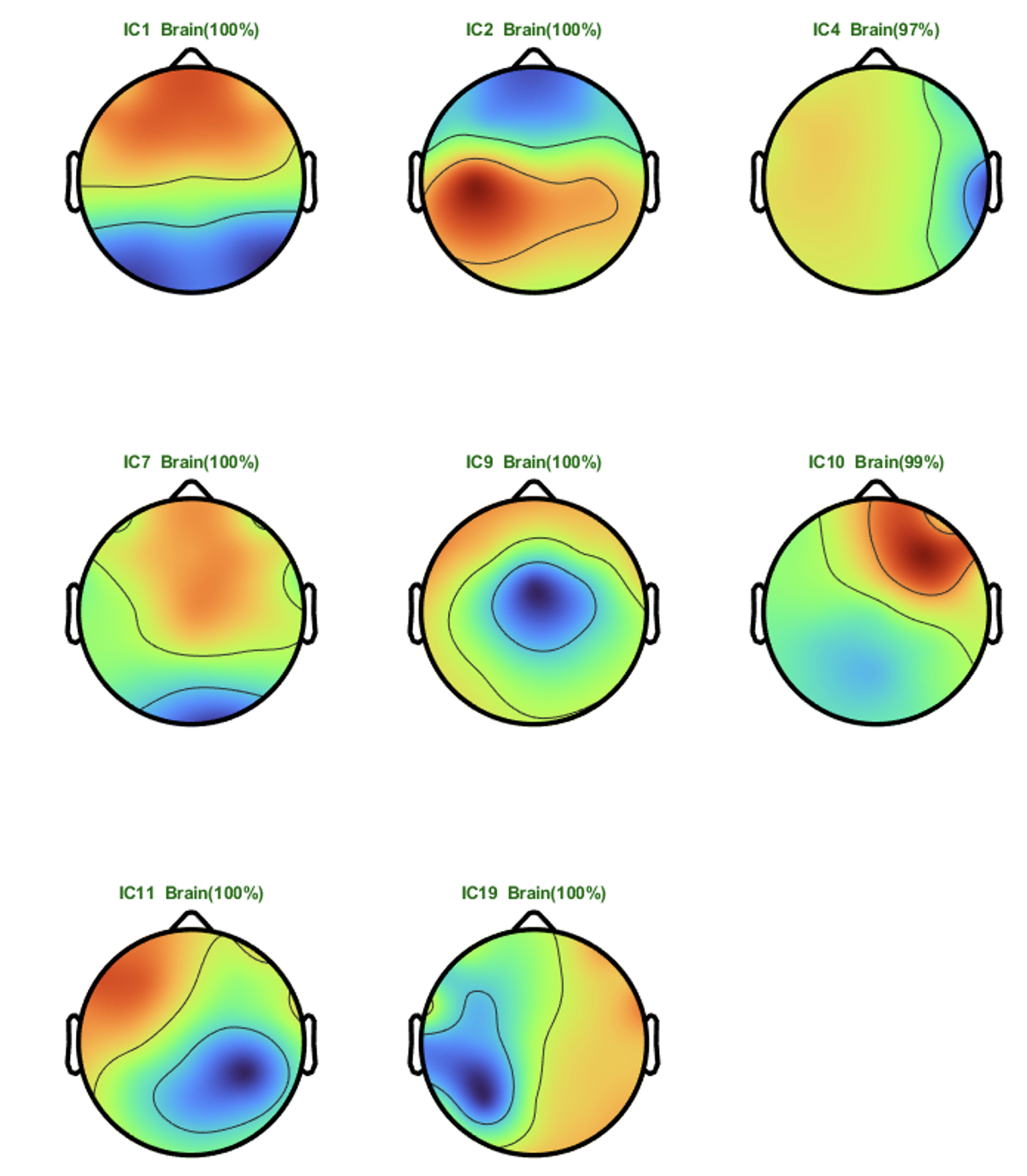 Six colored topographical maps of human brains, arranged in two rows of three. Each map is labeled with a different number and indicating the percentage of brain activity. The diagrams use color gradients from blue to red to depict varying activity levels.