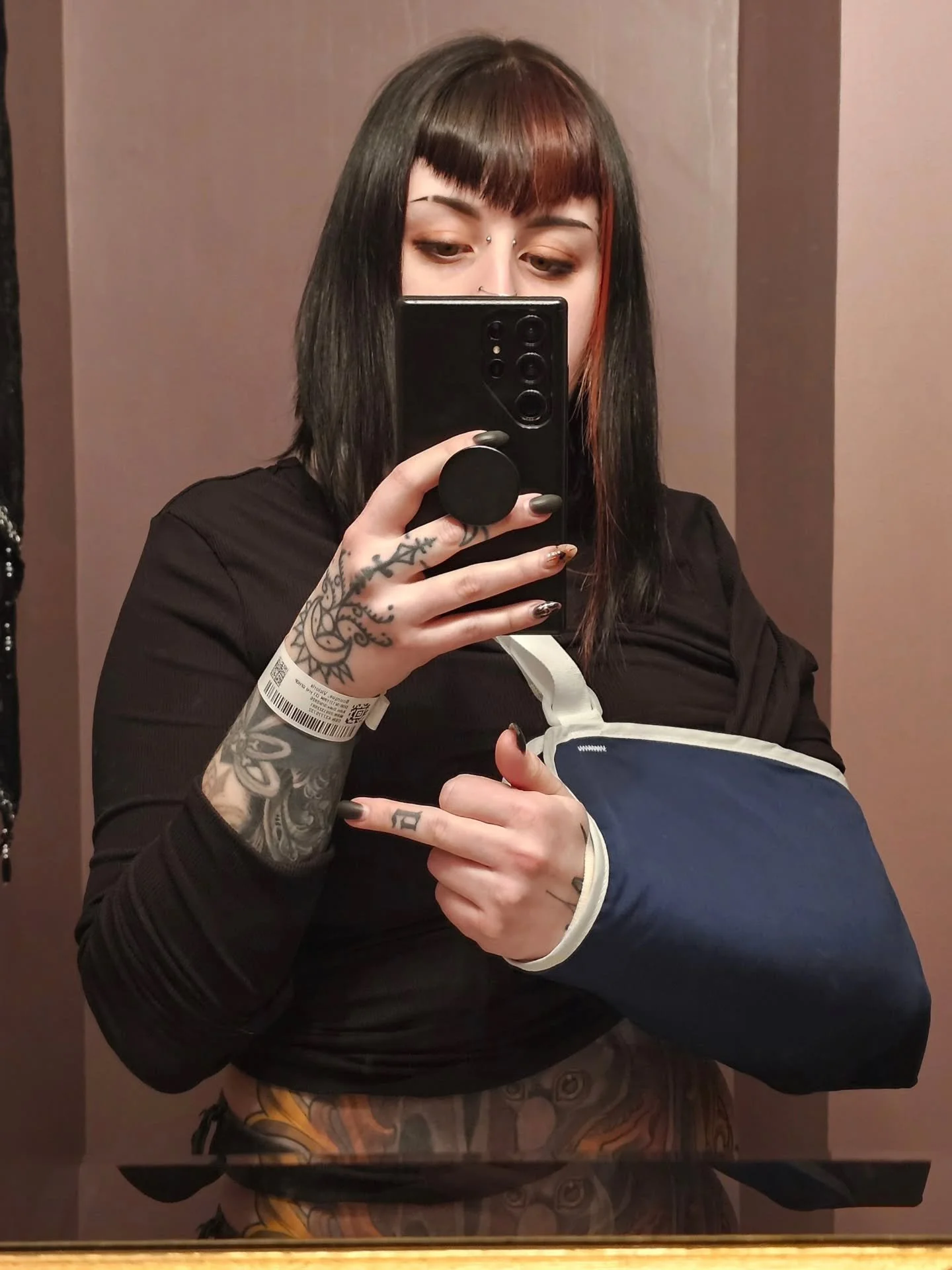 Hey everyone!
I high sided my motorcycle, and busted myself up.
I broke both elbows and need surgery on my right (dominant) elbow. Surgery will cost ~$20-25k out of pocket on top of my ER bill, and I don't have health insurance. 
I will be out of wor