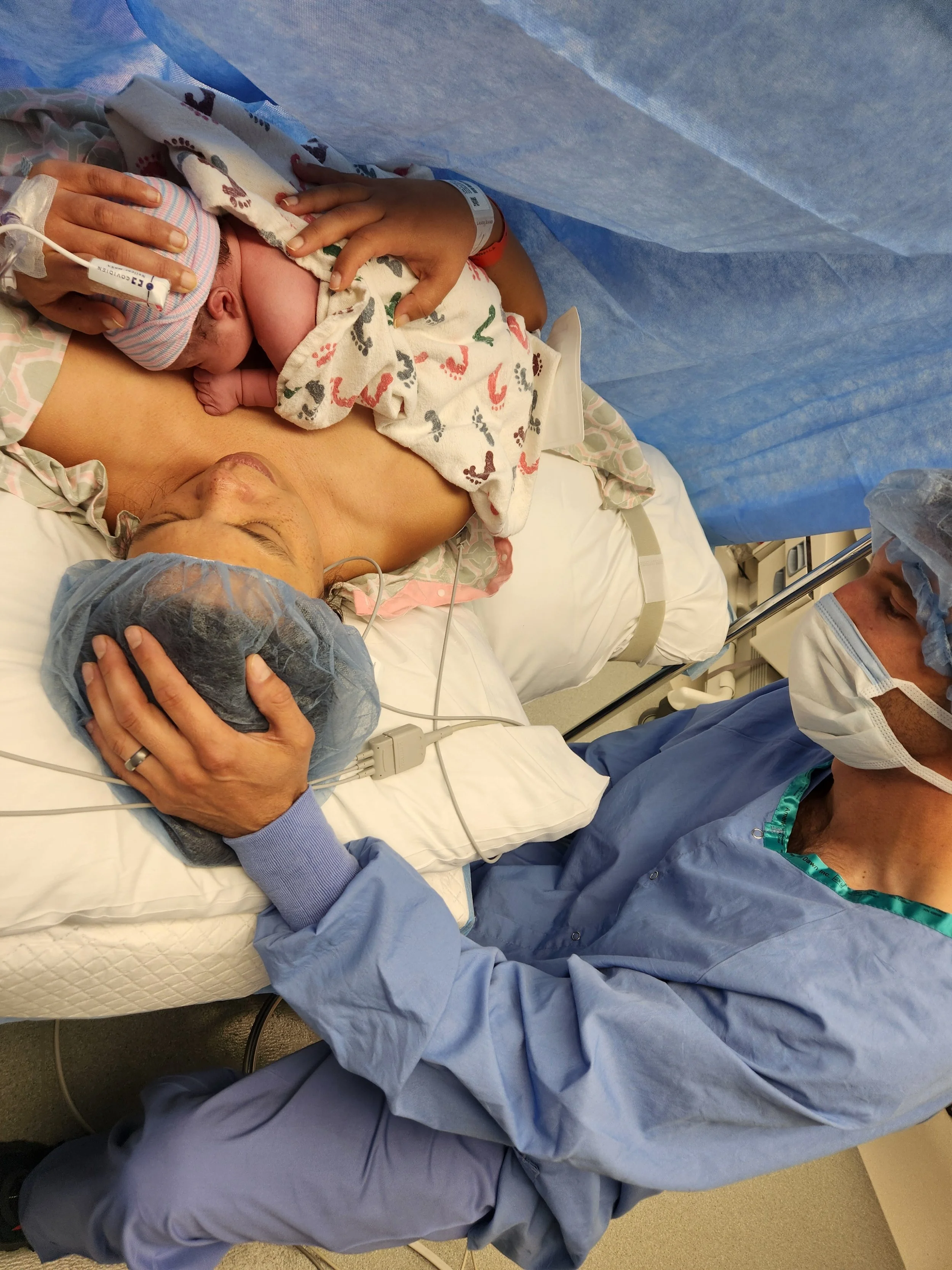 Doulas and Cesarean Births