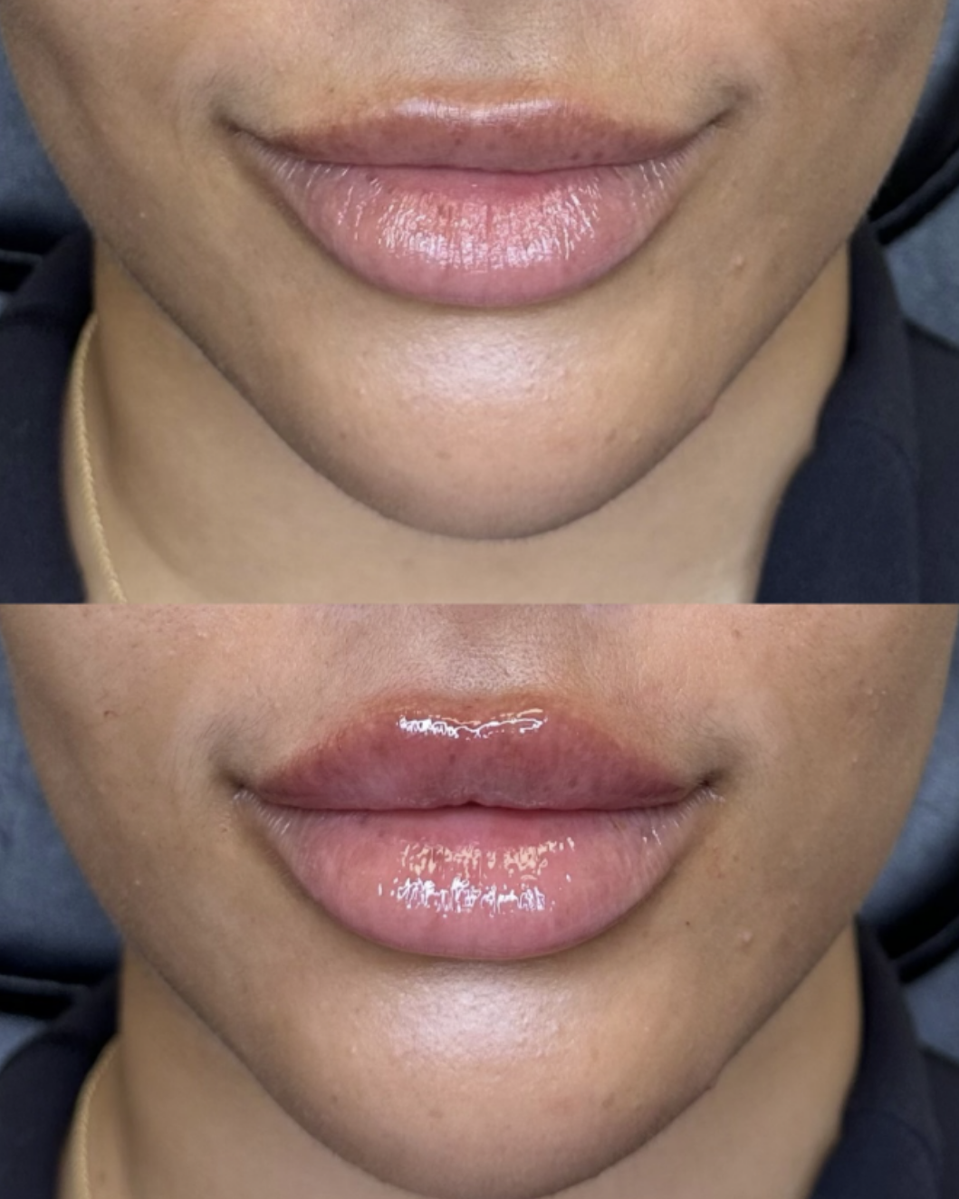 Close-up of a person's lips, shown before and after applying a shiny gloss or balm, with the top image featuring matte lips and the bottom image glossy and moisturized.