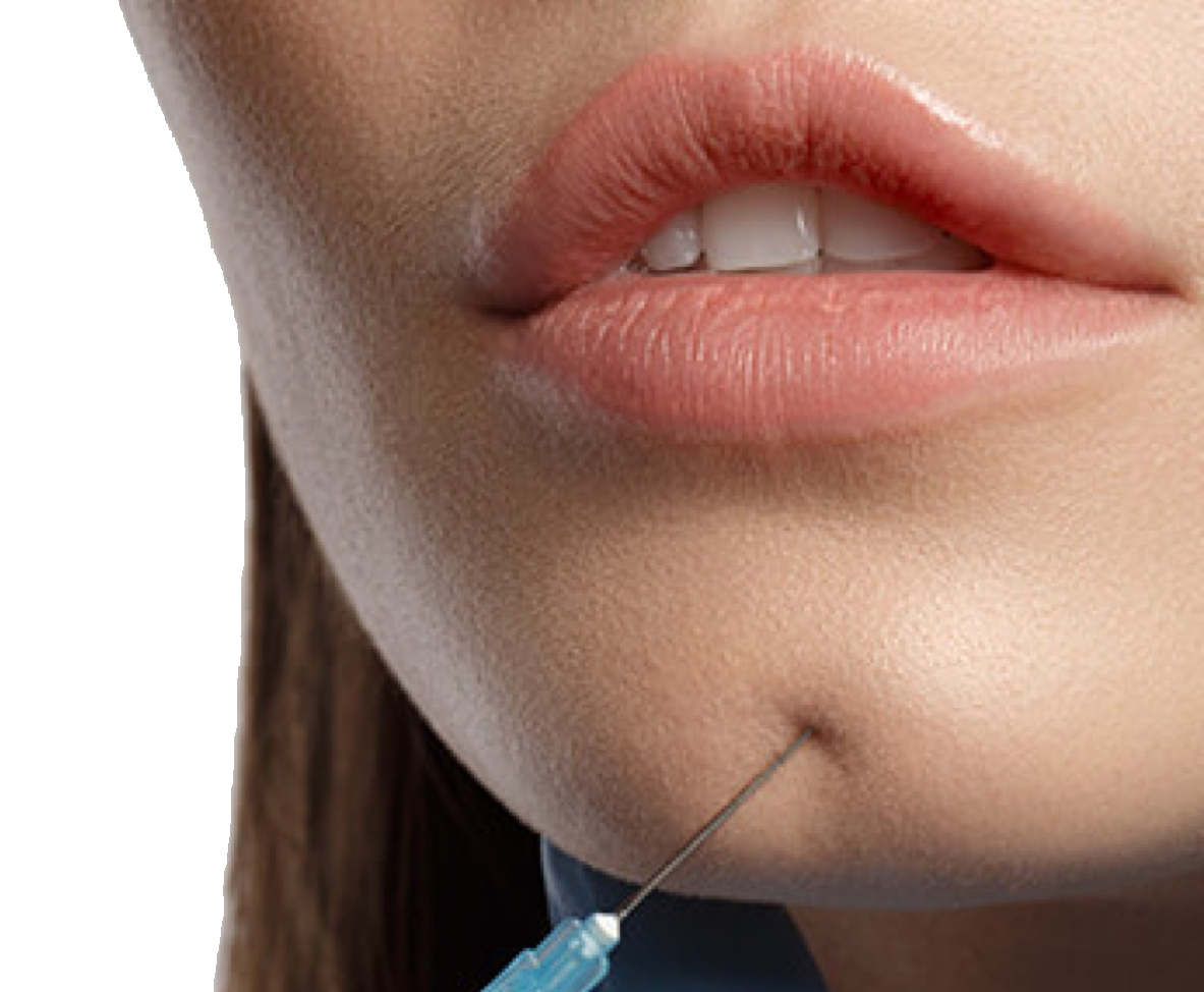 A woman receives a cosmetic dermal filler injection near her lips.