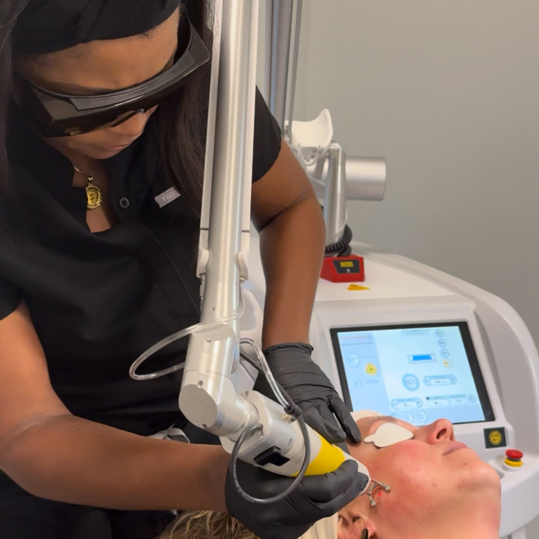CoolPeel &amp; CO2 Laser Resurfacing in Fort Mill, SC | New South MedSpa