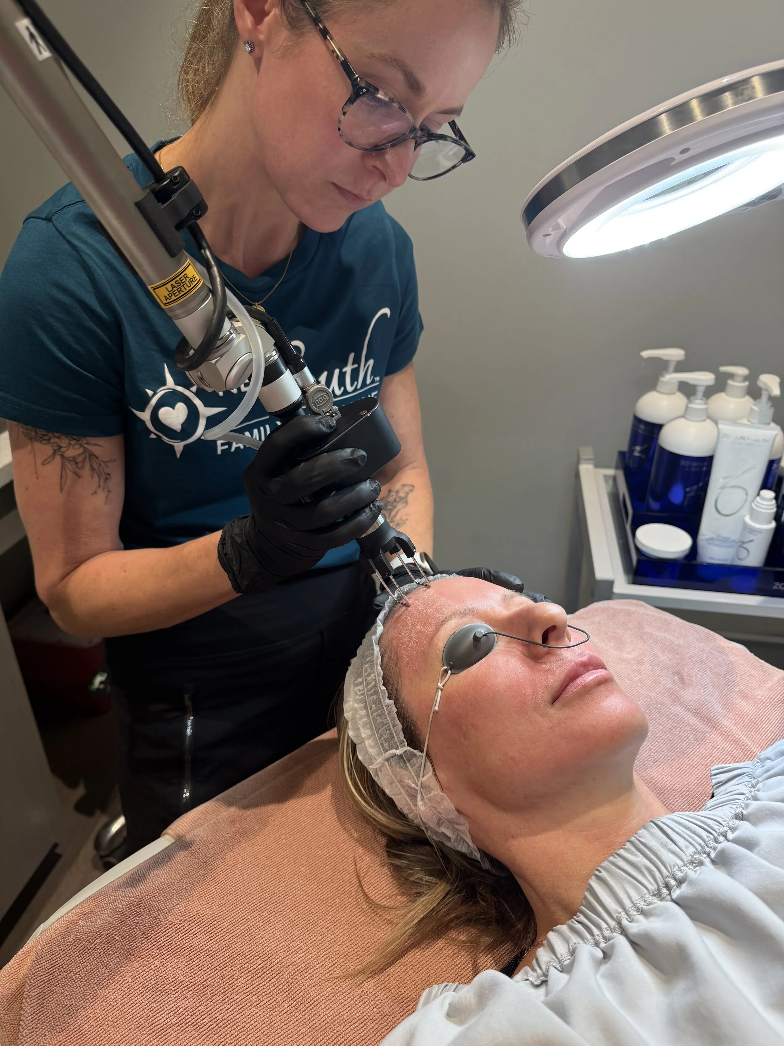 CoolPeel &amp; CO2 Laser Resurfacing in Fort Mill, SC | New South MedSpa