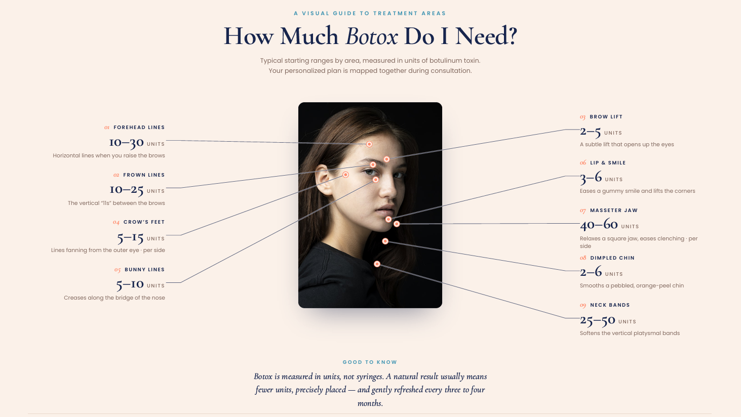 A visual chart showing typical Botox treatment areas on a woman's face, with labels and unit ranges for each area, including forehead lines, frown lines, crow's feet, bunny lines, brow lift, lip & smile, masseter jaw, dimpled chin, and neck bands.
