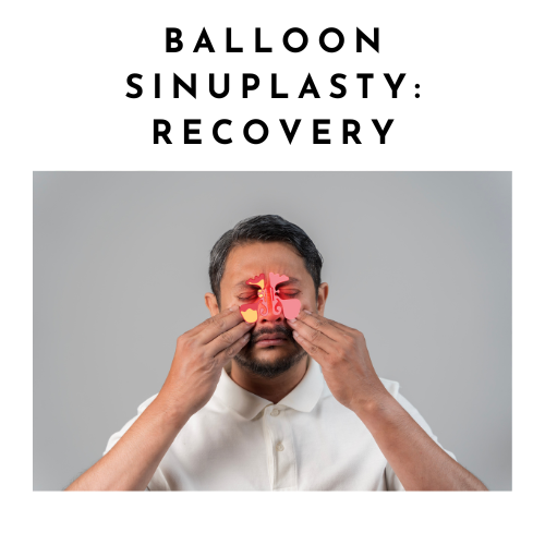 What should I expect after ballooon sinuplasty?