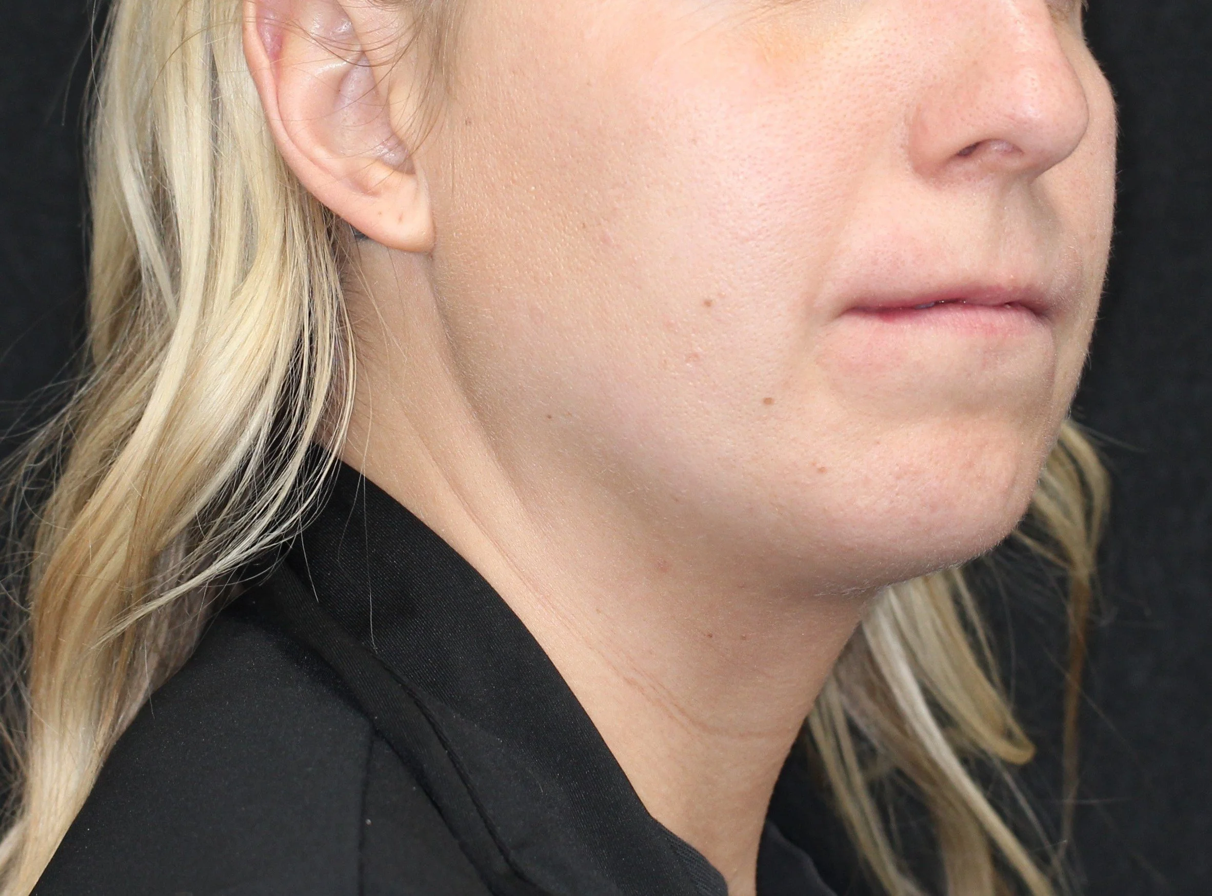 Recessed jaw position linked to airway strain