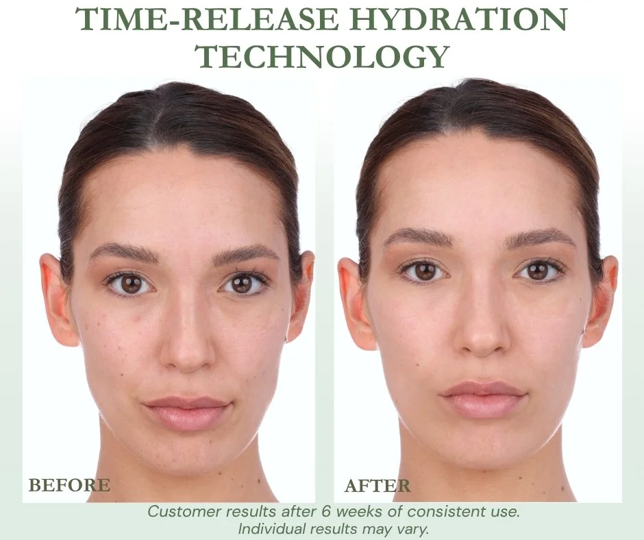 Side-by-side photo of a woman's face before and after 6 weeks of using a skincare product, showing improved skin clarity and hydration.