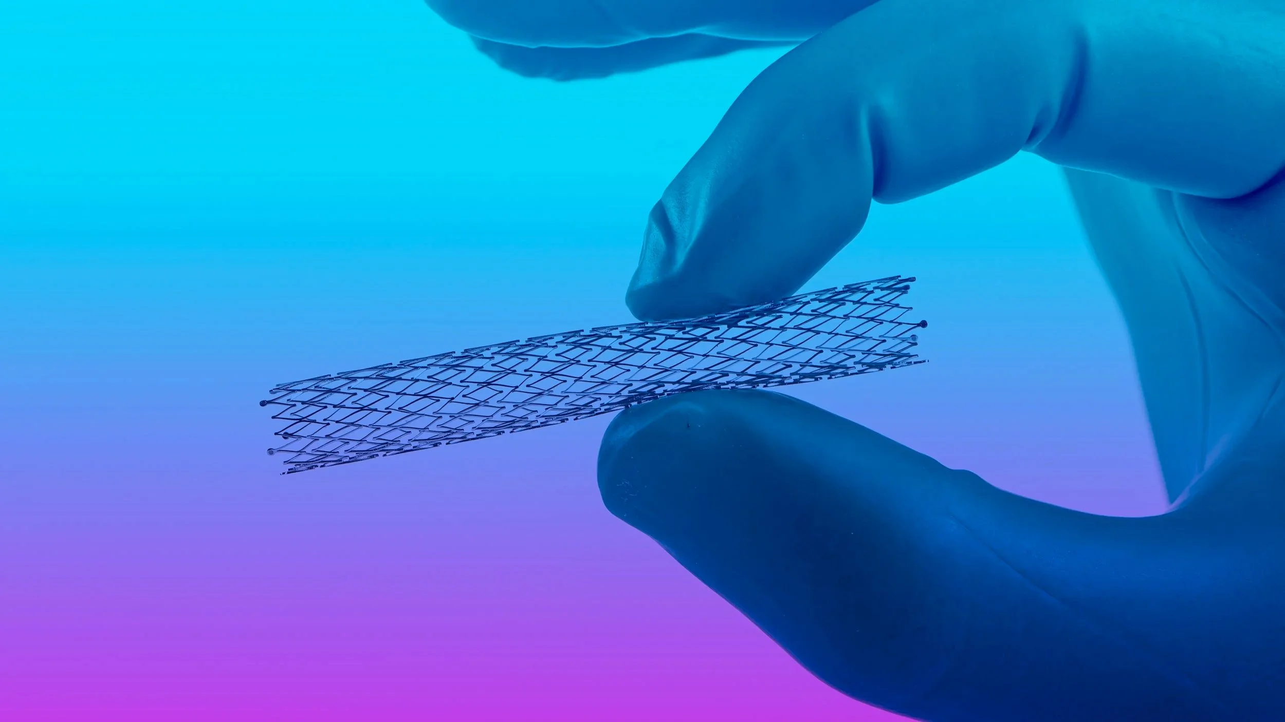 Micromachining of stents