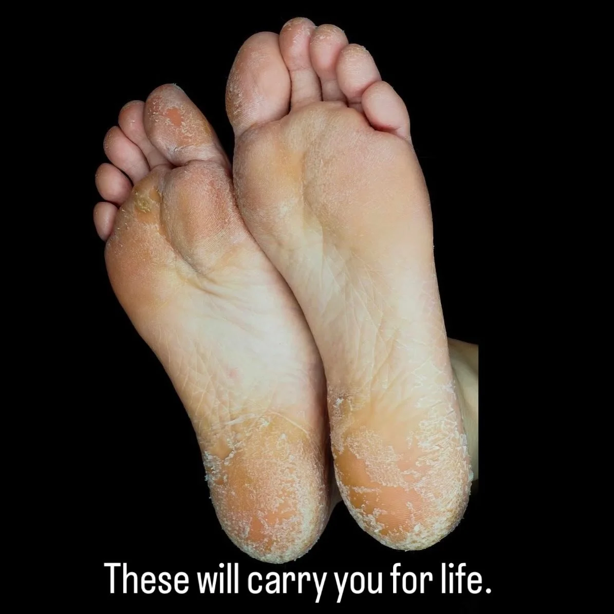 You will walk the equivalent of five times around the earth in your lifetime.

On these. 👣

Your feet carry your weight.
Your work.
Your life.

Dry heels. Thick callus. Cracked skin.
Not cosmetic.

Pressure.
Neglect.
Warning signs. ⚠️

A medical ped
