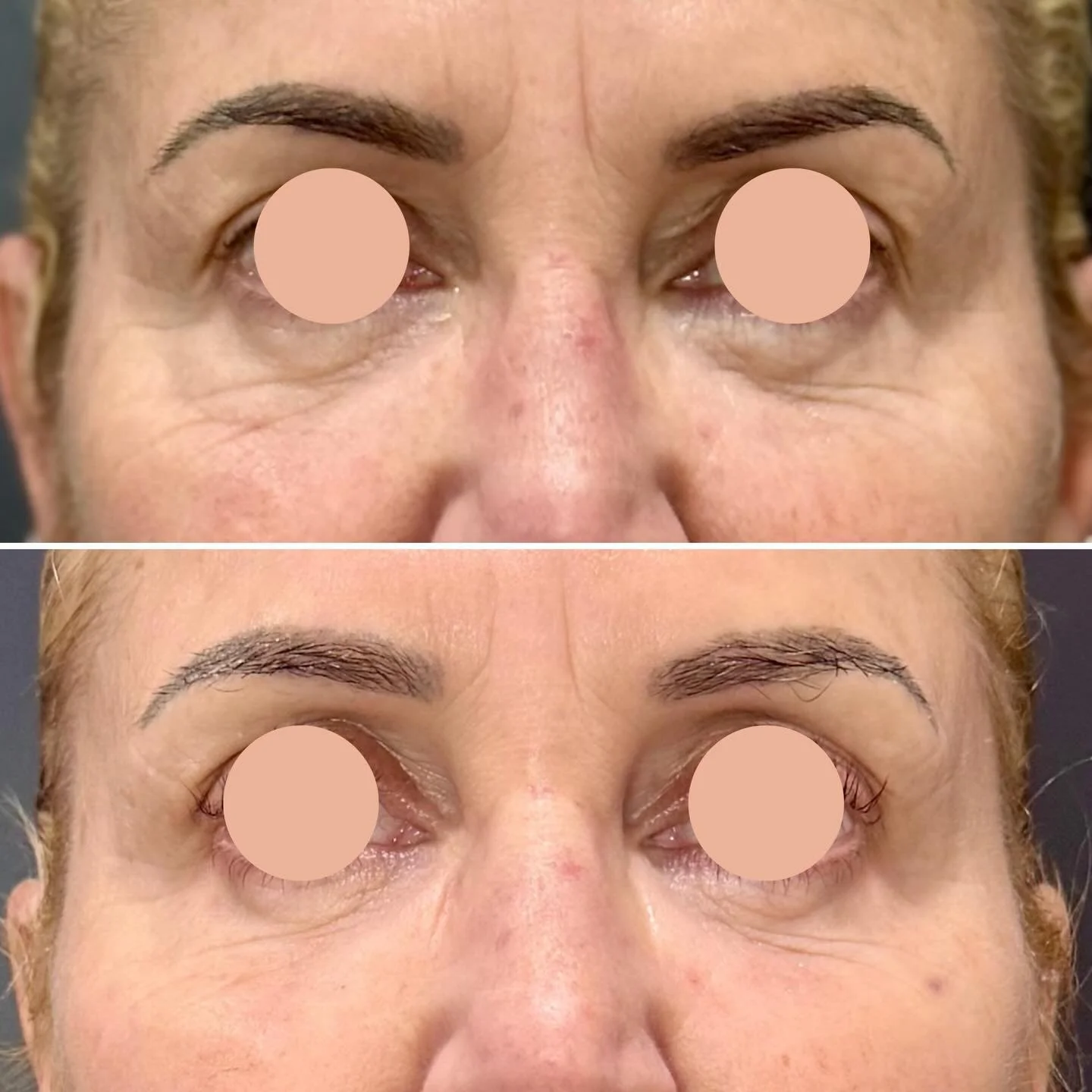 Ok, I&rsquo;ve had some people message and ask about her under eyes and I said we&rsquo;d talk about her regimen- so here it is:
Same Face, Recarge🤩
Dark circles, fine lines, thinning skin, this under-eye zone can really tell all your secrets- or li