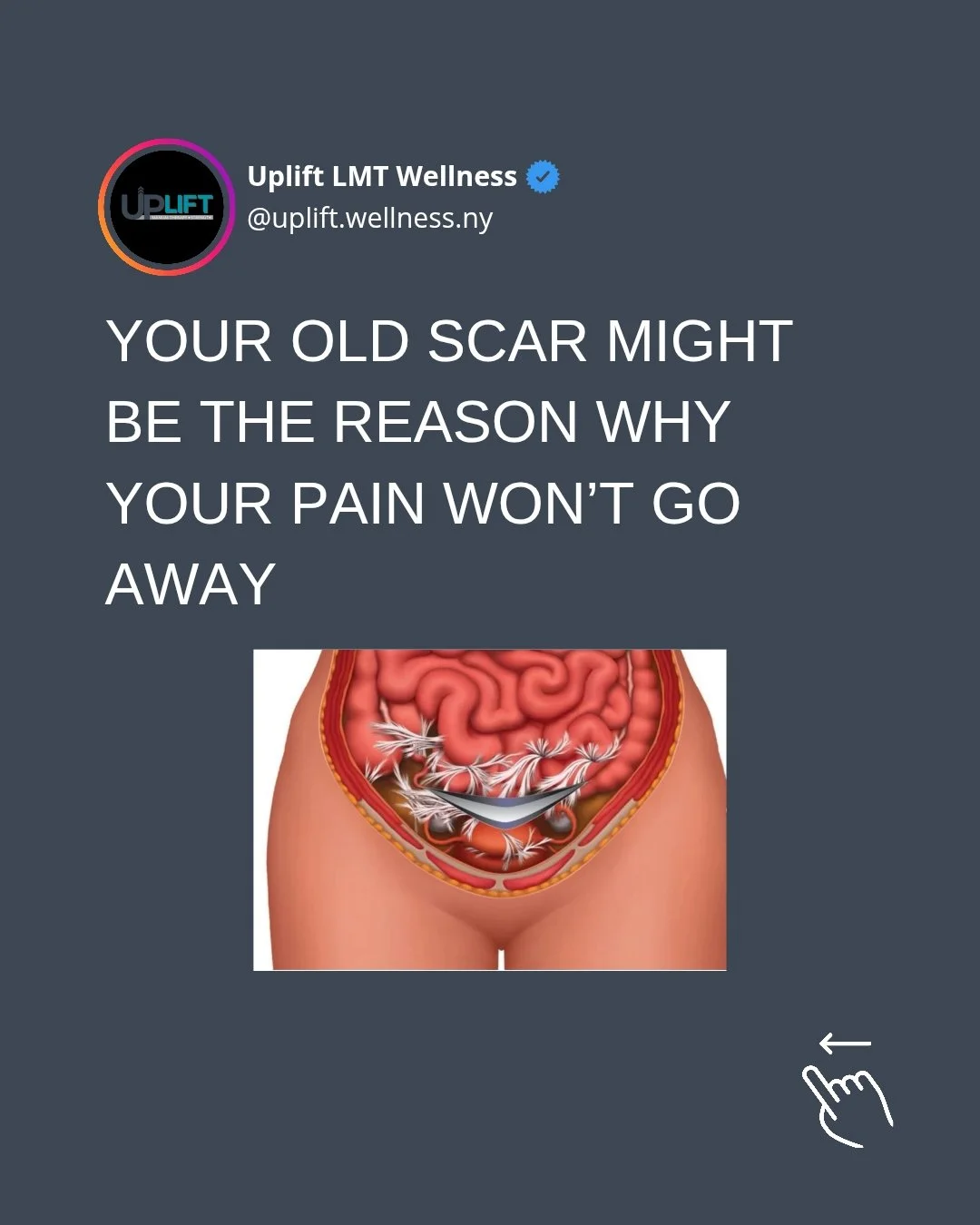 YOUR OLD SCAR MIGHT BE THE REASON WHY YOUR PAIN WON'T GO AWAY 

Scars don't just close up and do nothing afterwards. They always have some lasting effect on your body, especially if there is significant trauma (physical or emotional).

Scars are goin