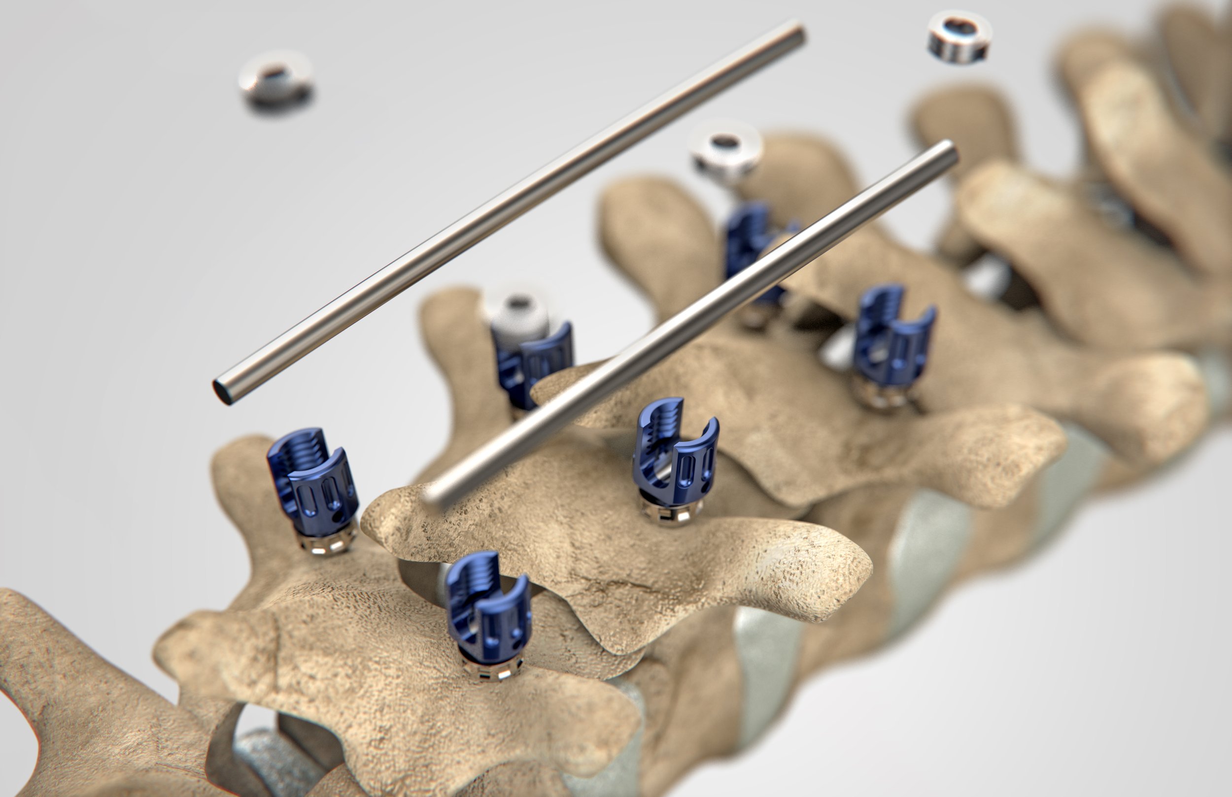 Renderings & Sketches