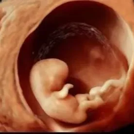 The Sweet Pea (10-13 weeks)