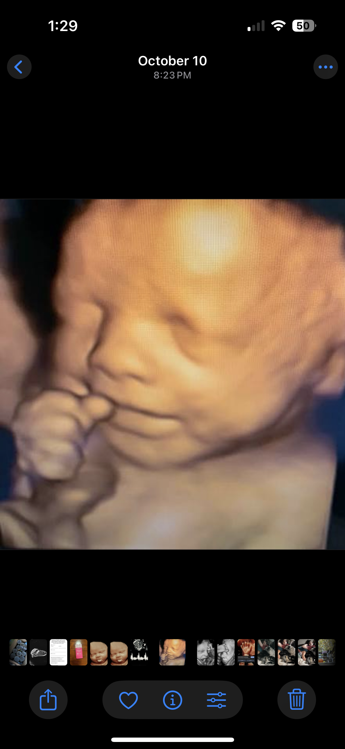 Close-up of a 3D ultrasound image showing a developing fetus with eyes closed, nose, mouth, and hand near face.