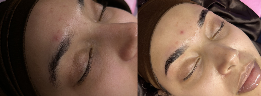 BEST WAXER NEAR ME HAIR REMOVAL NO SHAVING PERFECT SKIN CARE GLOWING SOFT SKIN BRAZILIAN WAXING BUCKS COUNTY PA DOYLESTOWN PA WARMINSTER WARRINGTON PHILLY SUBURBS ESTHETICIAN NEAR ME WAXING WAXER SELF CARE AFTER CARE BROW ARTIST TINT BROW LAMINATION