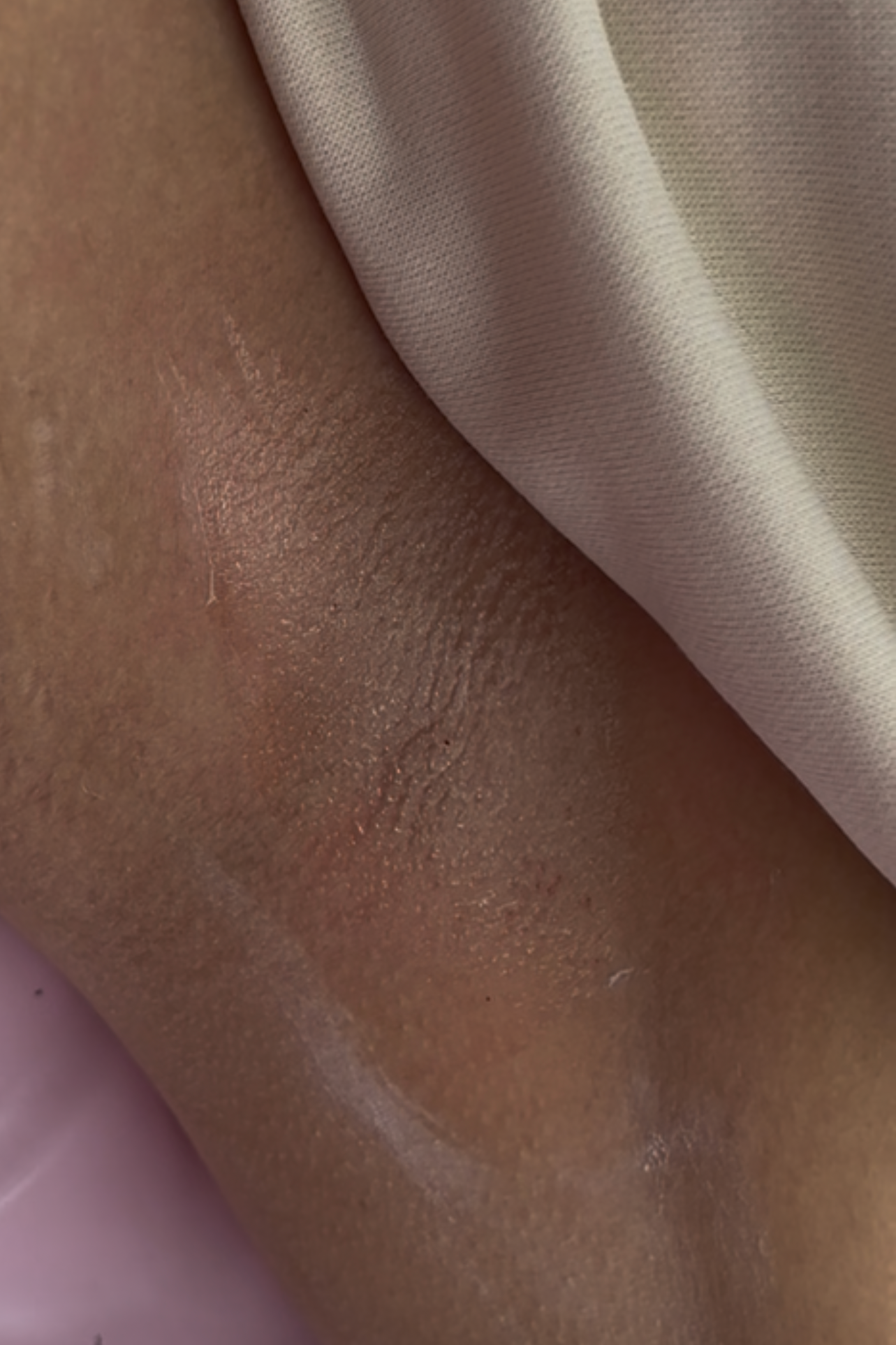 after results, glowing healthy clear skin, underarm wax, smooth skin, results armpit waxing waxer near me ,body wax, Brazilian waxing ,lasting long results, hair removal, transformation, self care, Doylestown pa, bucks county pa, philly