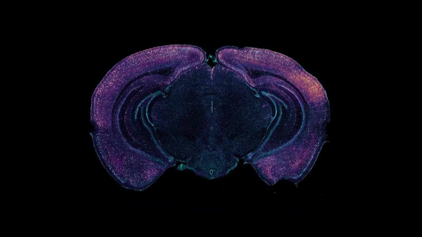 40 Hz hersenstimulatie: wat de wetenschap zegt over gamma en hersengezondheid