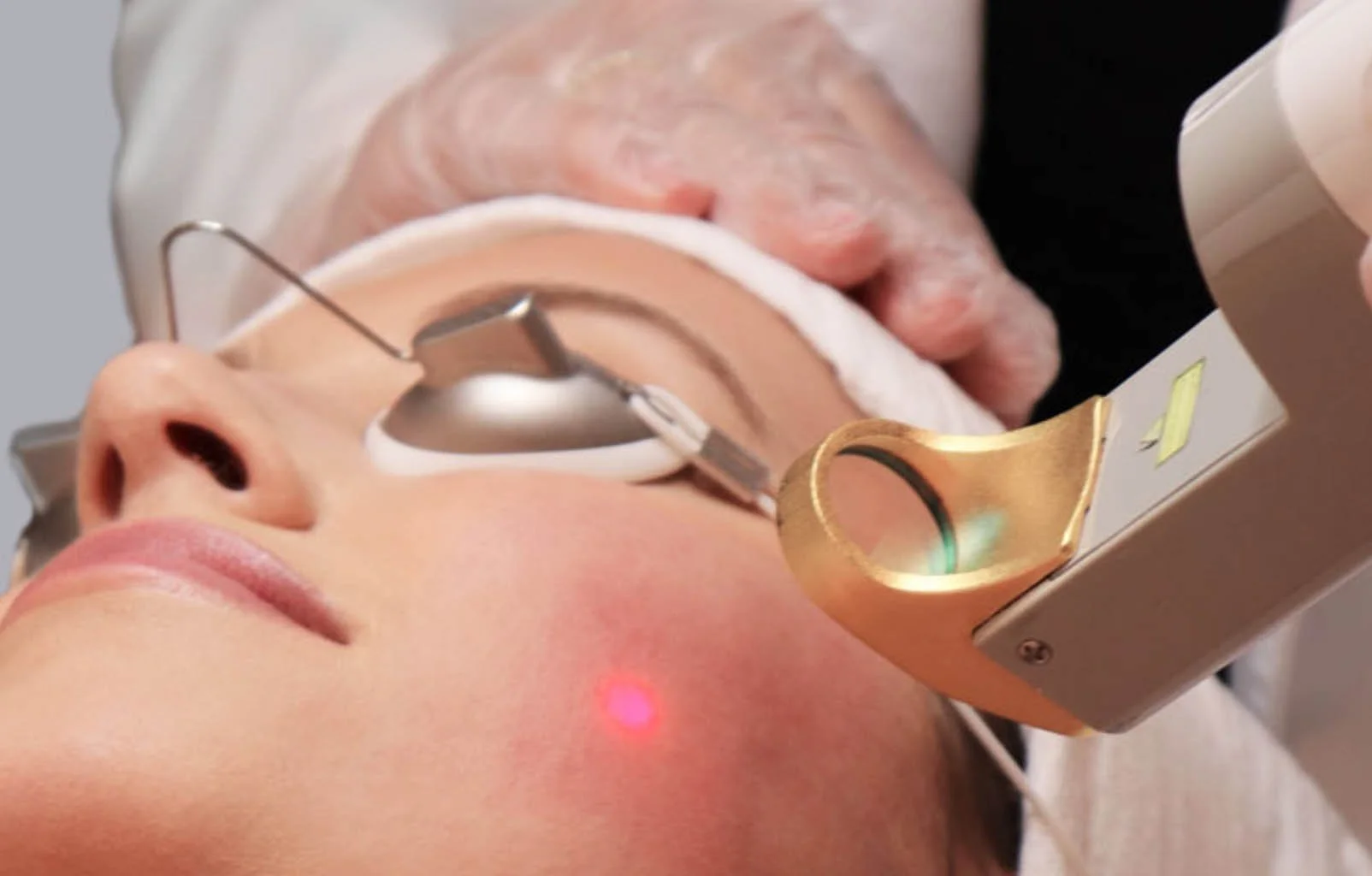 Laser Genesis: Smooth, Brighten &amp; Revitalize Your Skin