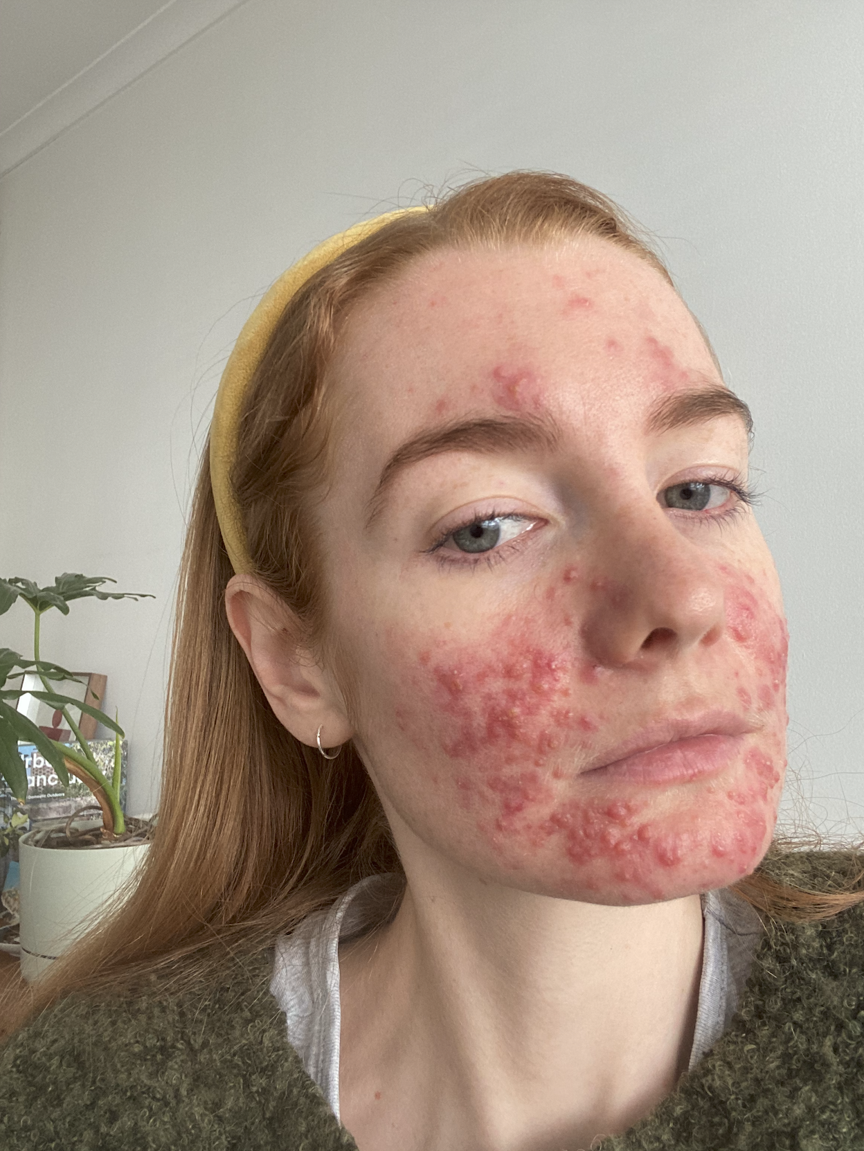 Skin.png