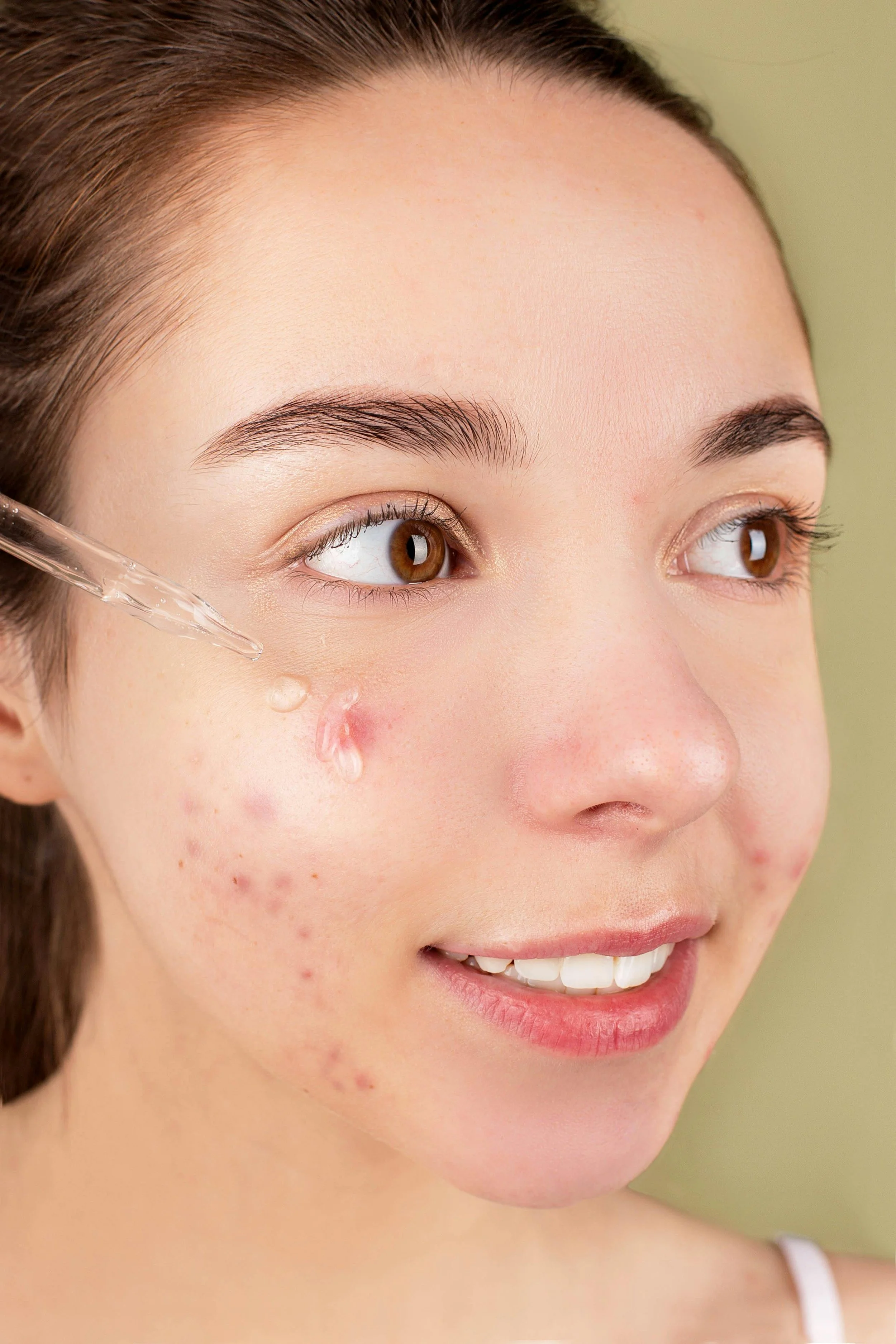 Close-up of a young woman with brown hair and brown eyes, applying skincare serum around her eye area using a dropper.