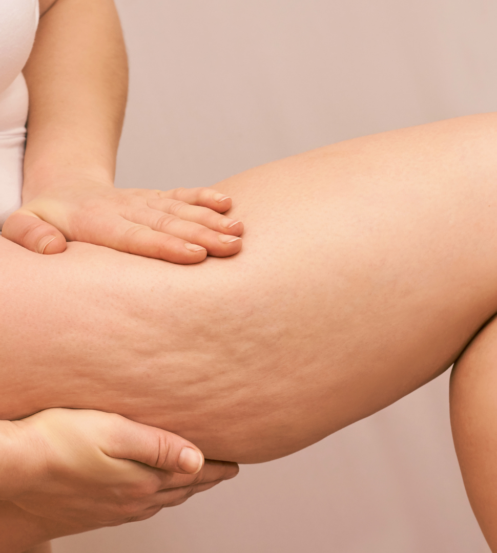 Close-up of a person receiving a massage on their thigh, with a second person applying gentle pressure with their hand.