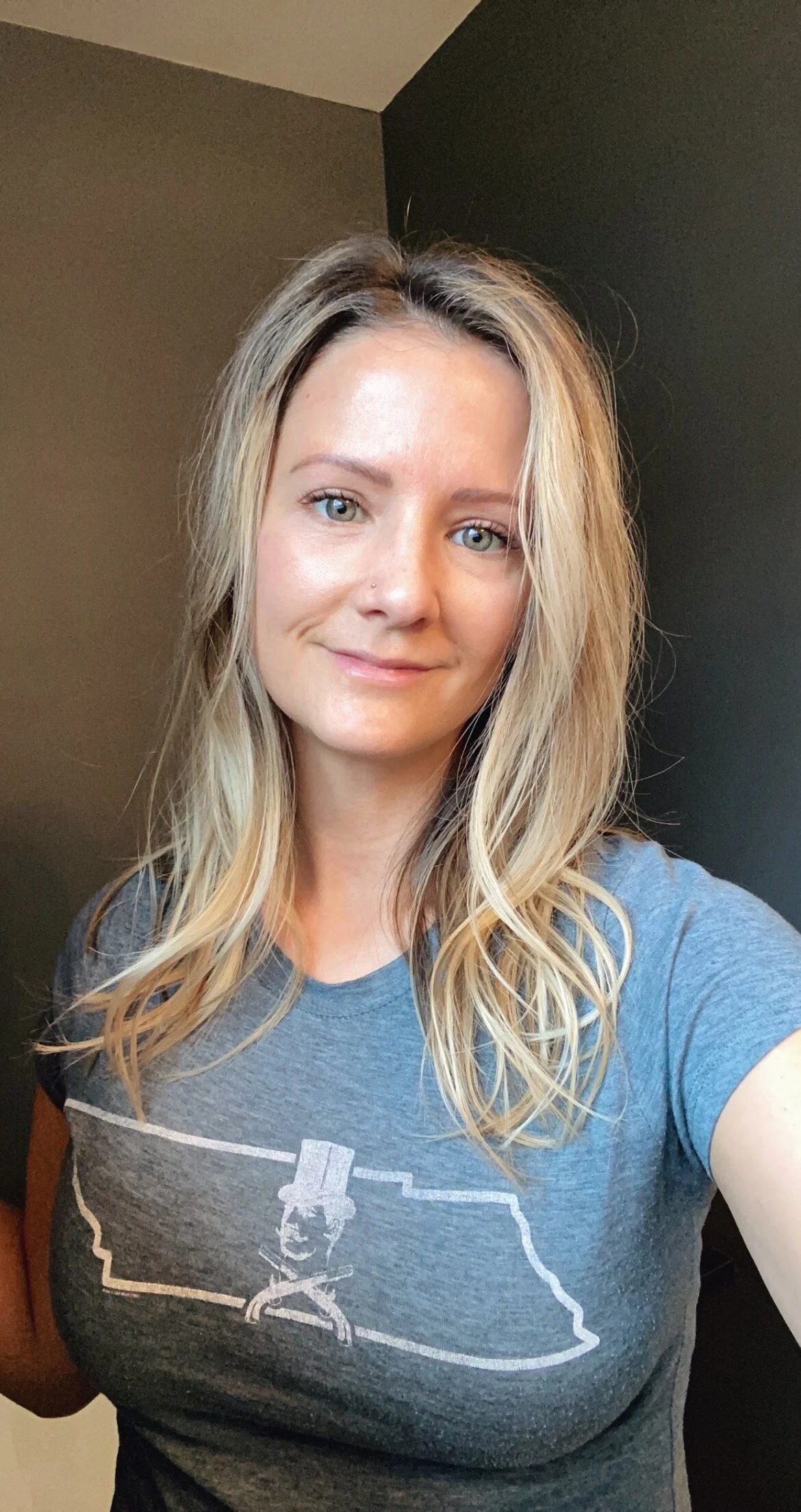 So They Tell Me I Have Rosacea 