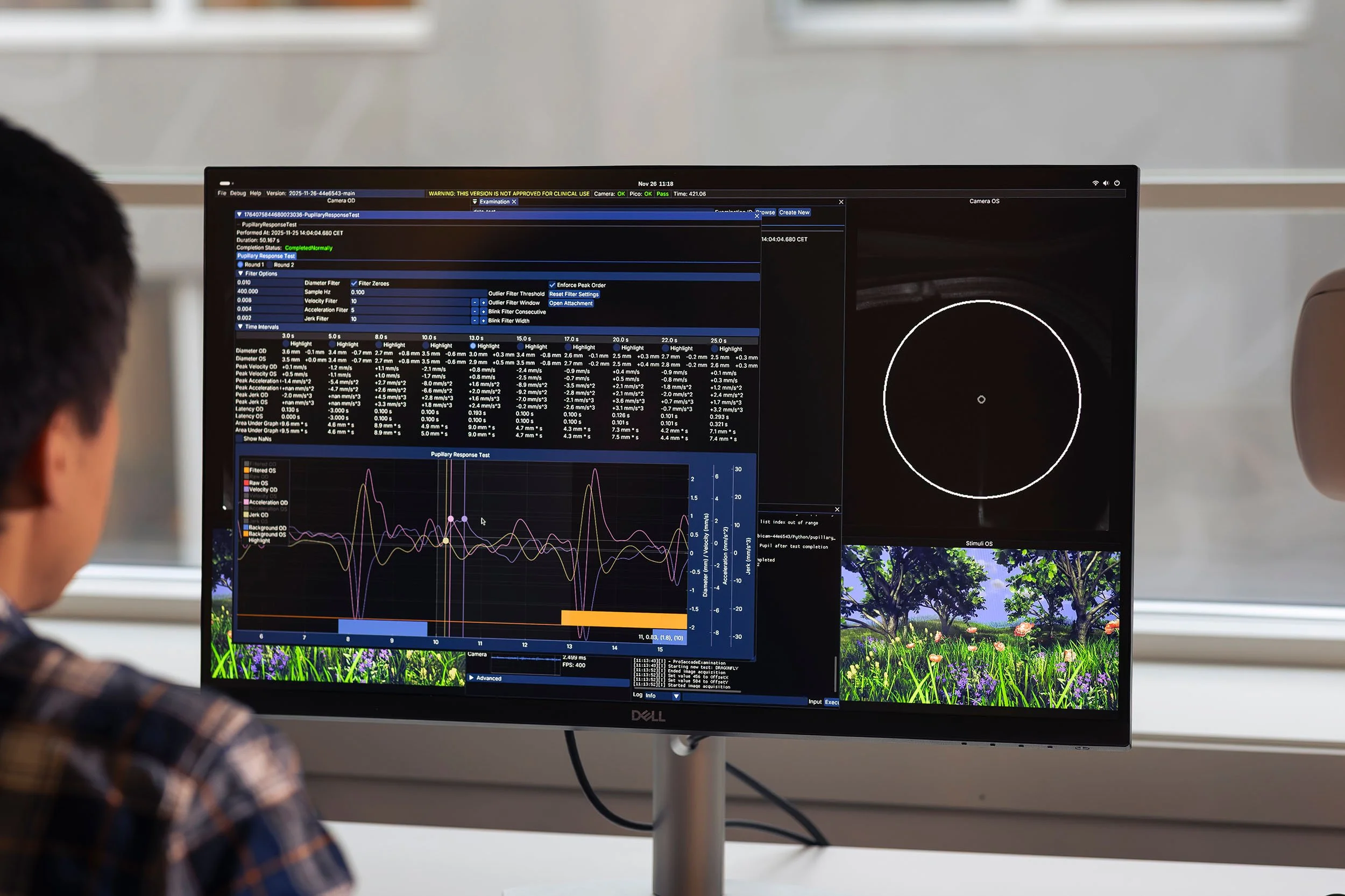 Researcher looking at a large monitor displaying test results in medical software.