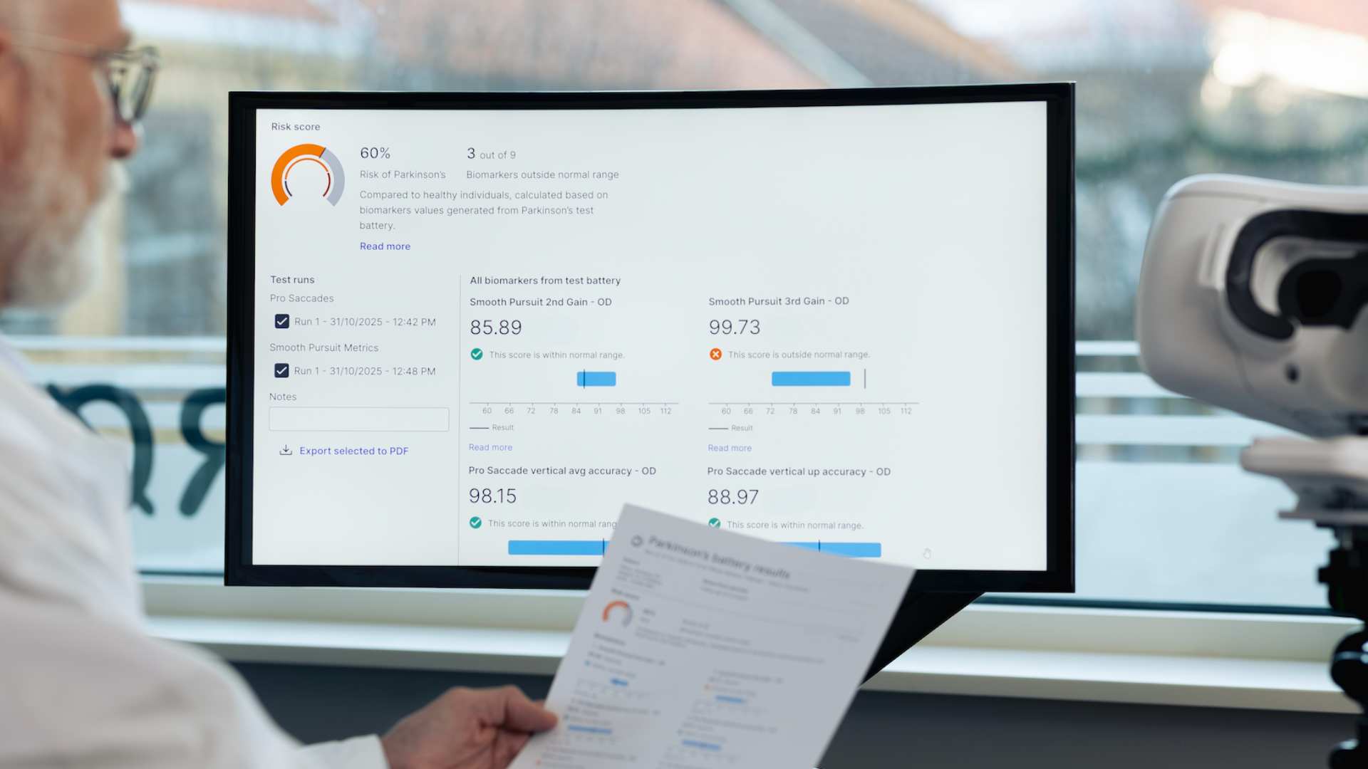 A doctor is looking at results in the BulbiCARE software.