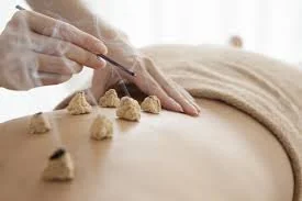 Yin Yoga met Moxa @ Yurt Idegem / Geraardsbergen