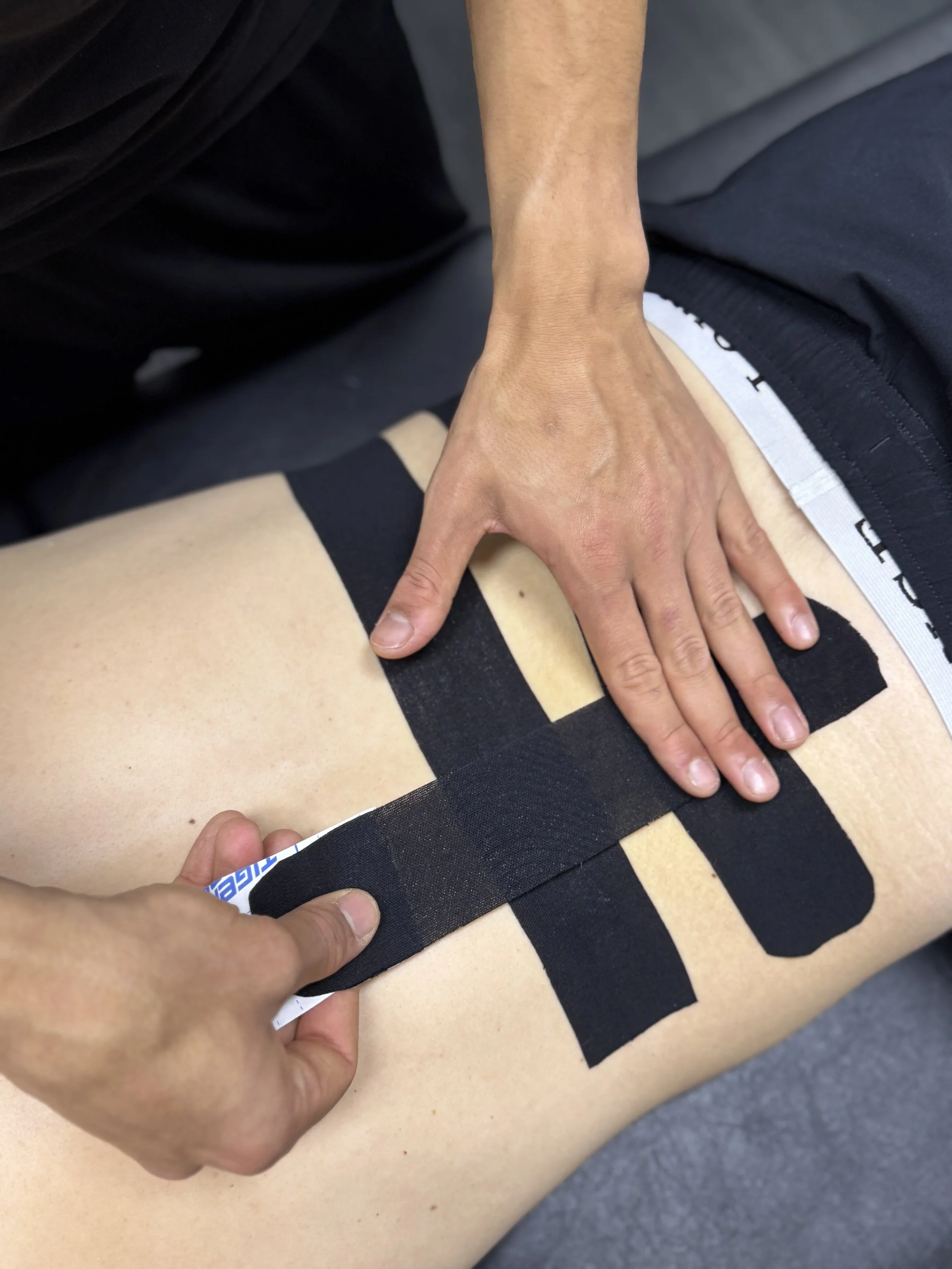 A sport therapist applying tape to a patients lower back
