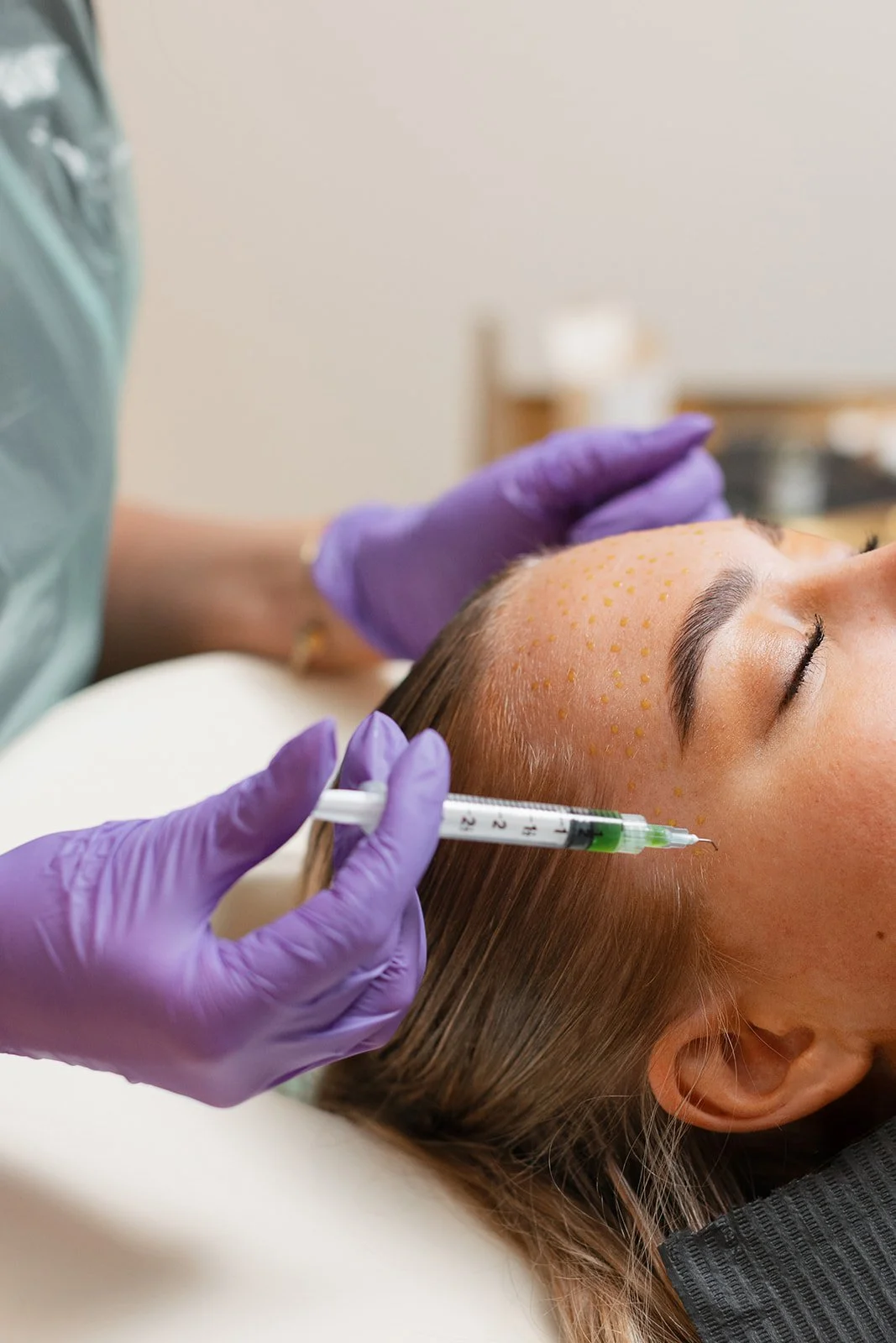 A person is lying on a treatment bed with her eyes closed, while another person wearing purple gloves administers a cosmetic injection into her forehead.