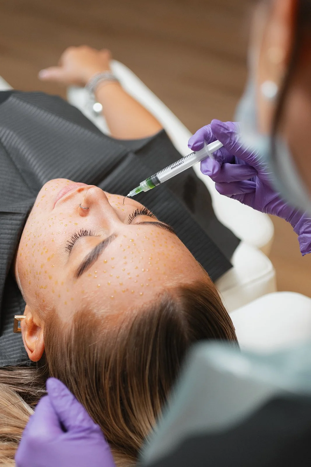 A woman lying down during a facial treatment, with small dots marked on her forehead, receiving an injection from a healthcare professional wearing purple gloves.