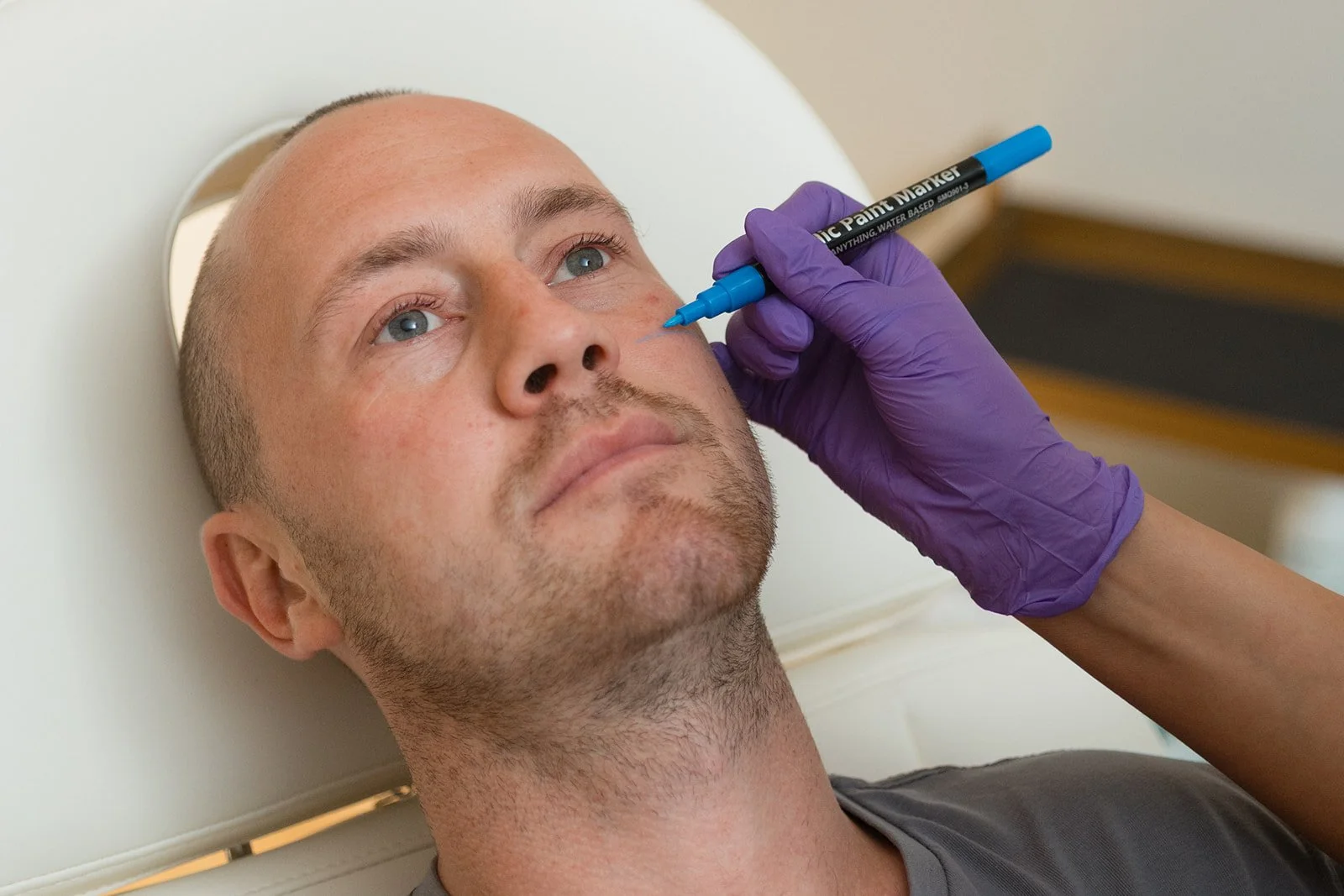 Clinician is using a special pen to mark treatment areas on young man
