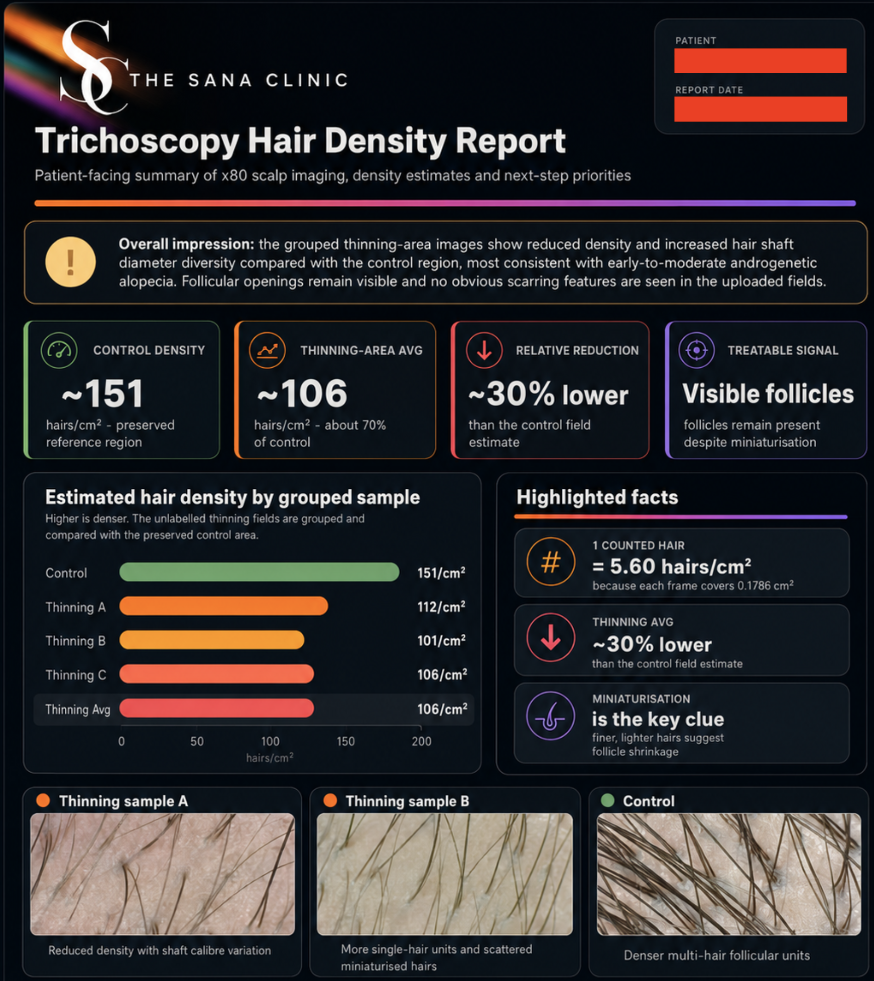 Trichoscopy Hair Loss Analysis at The Sana Clinic: A Bespoke, Evidence-Based Approach to Hair Restoration