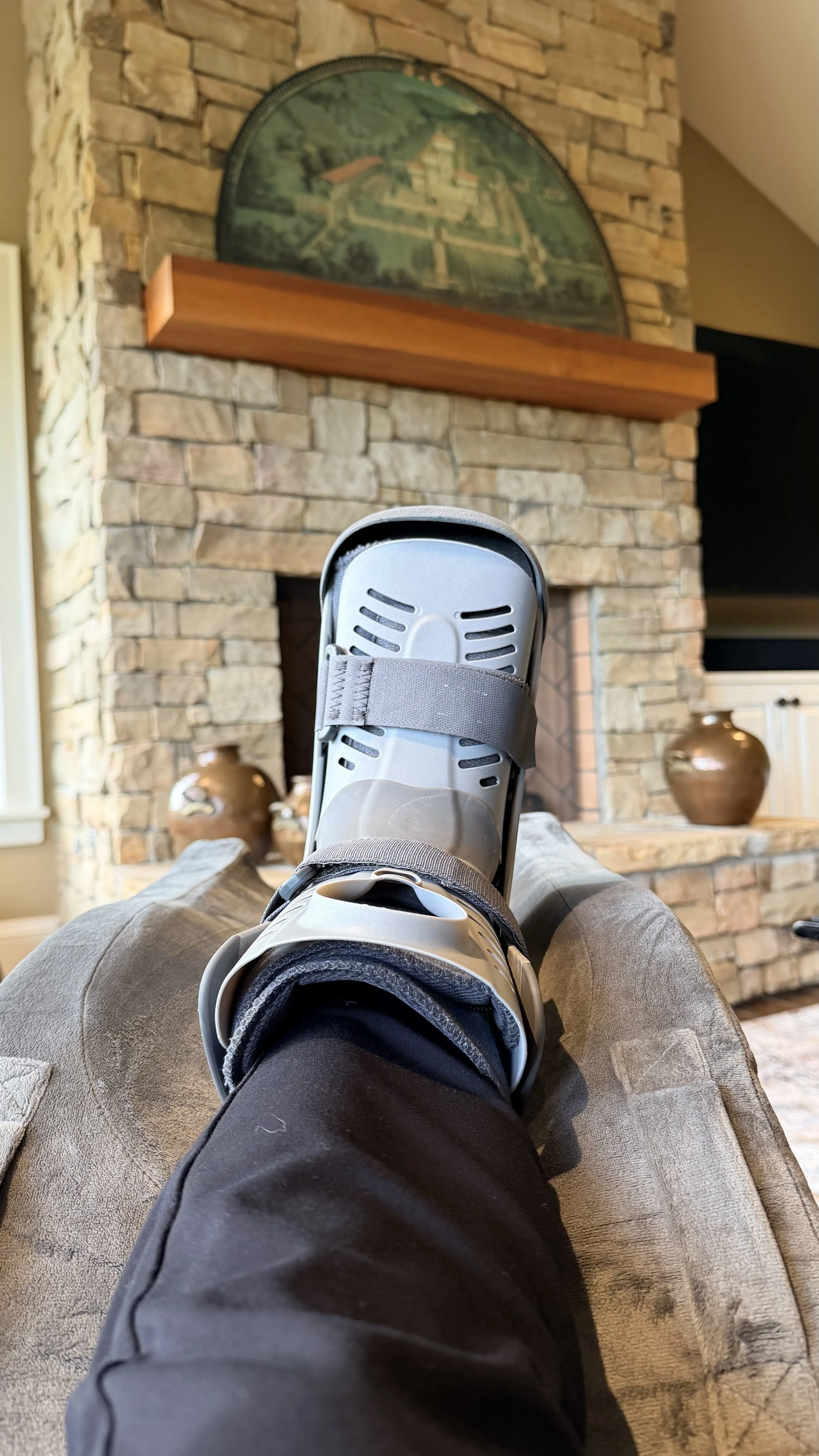 Some Weeks Just Taste Like Lemons: A Real-Life Foot Surgery Recovery Update