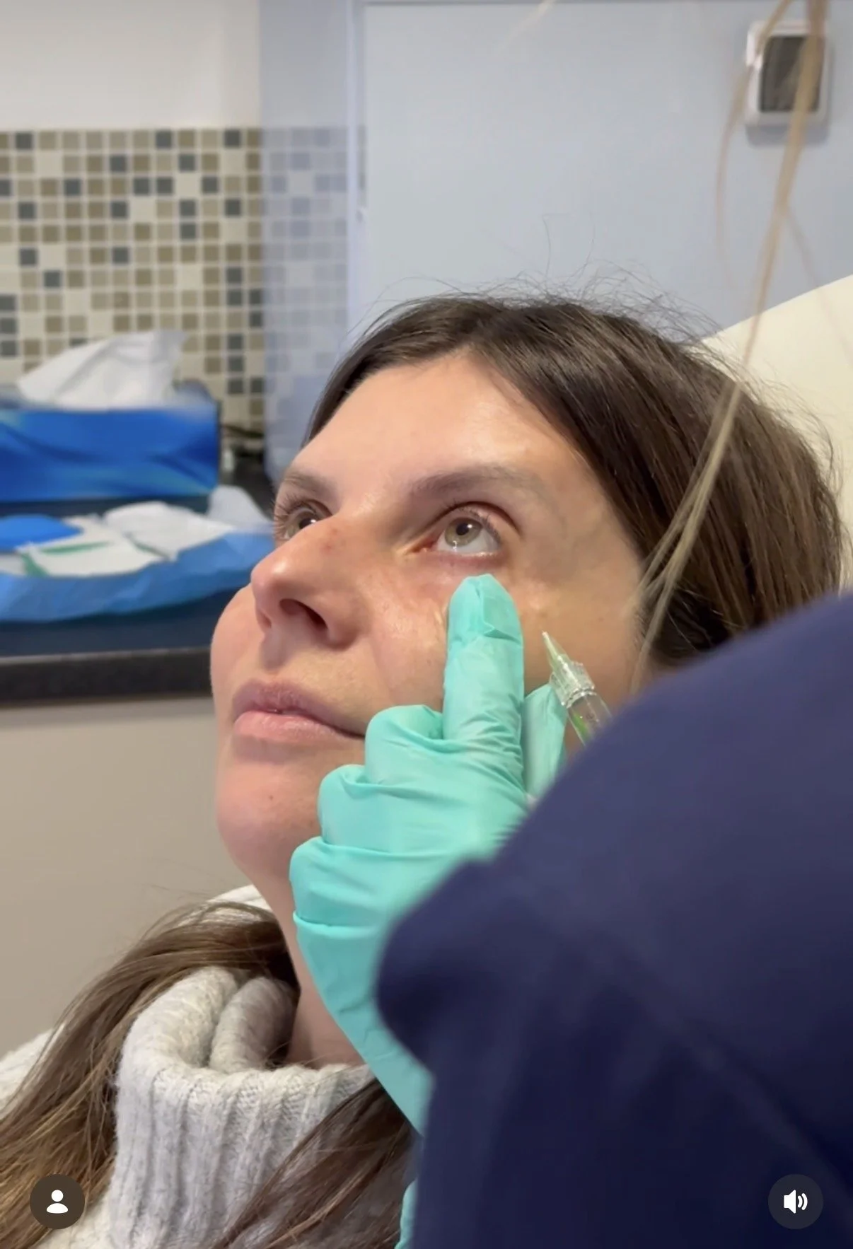 Polynucleotides for skin regeneration: Benefits and why I use Croma PolyPhil products