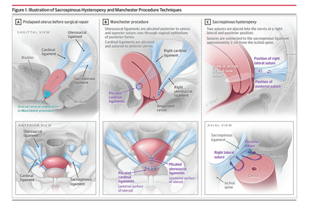 An example of a medical illustration