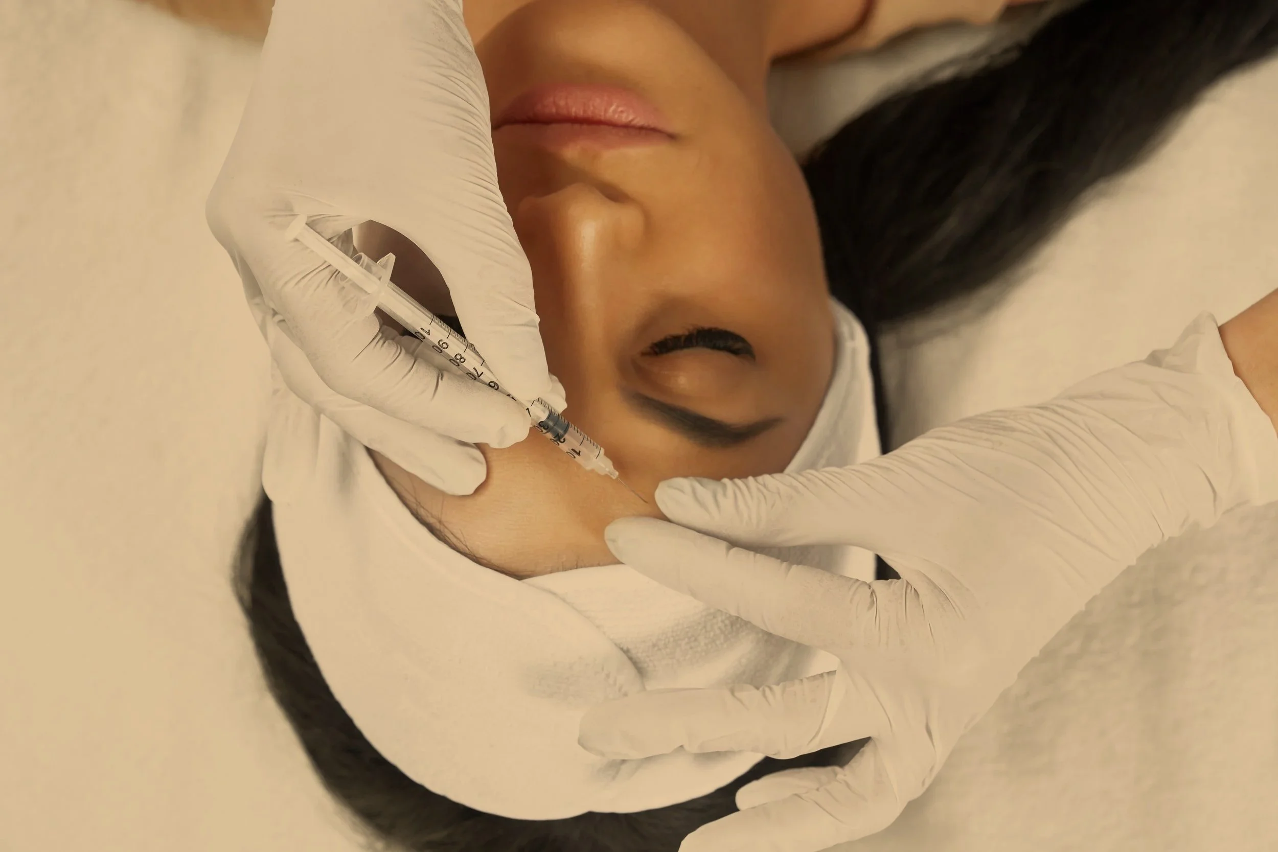 A person receiving a cosmetic injection around the eye area, with medical gloves and a syringe.