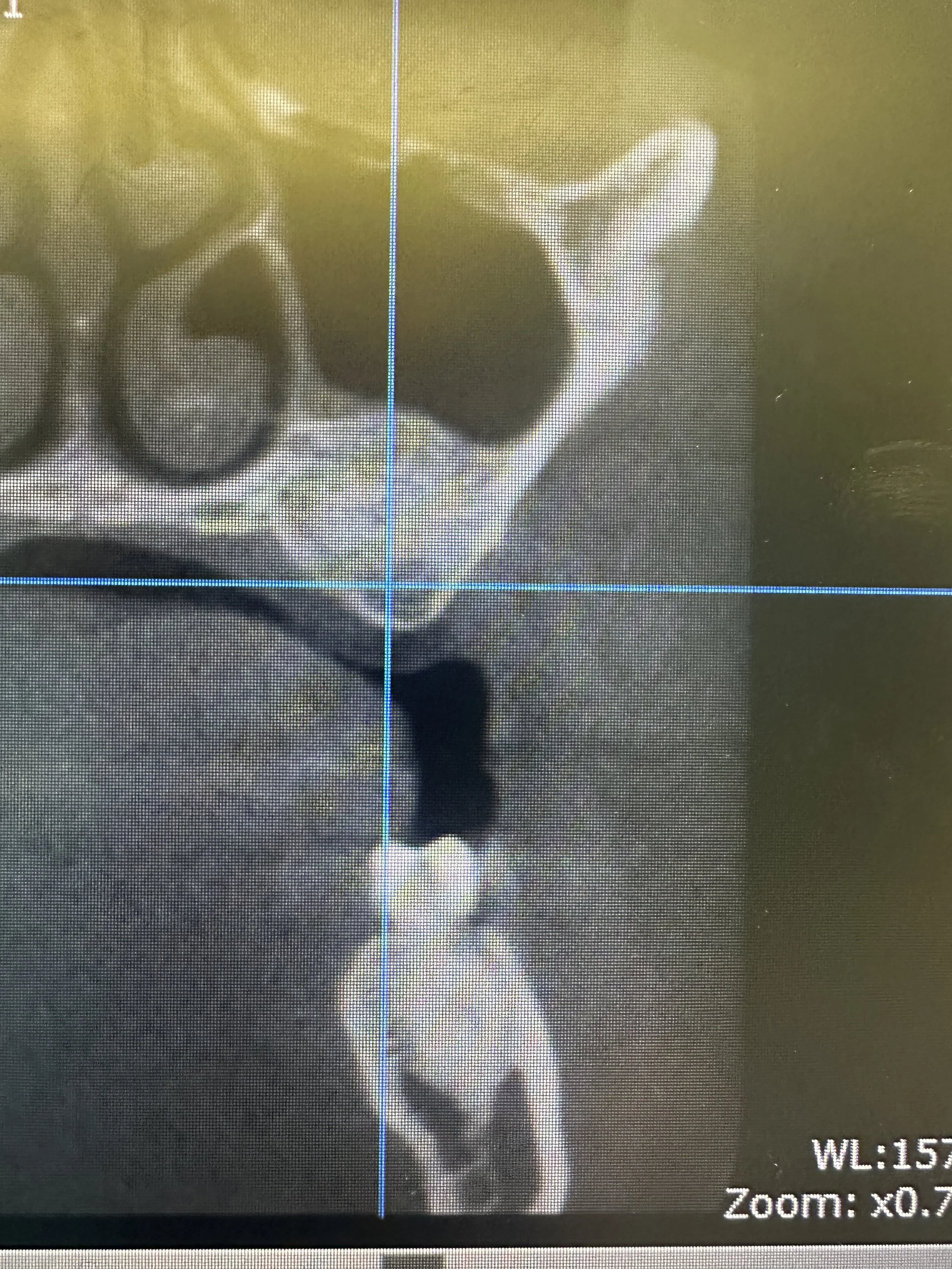 For professional reference only. All cases are anonymized and shared with patient confidentiality strictly maintained.