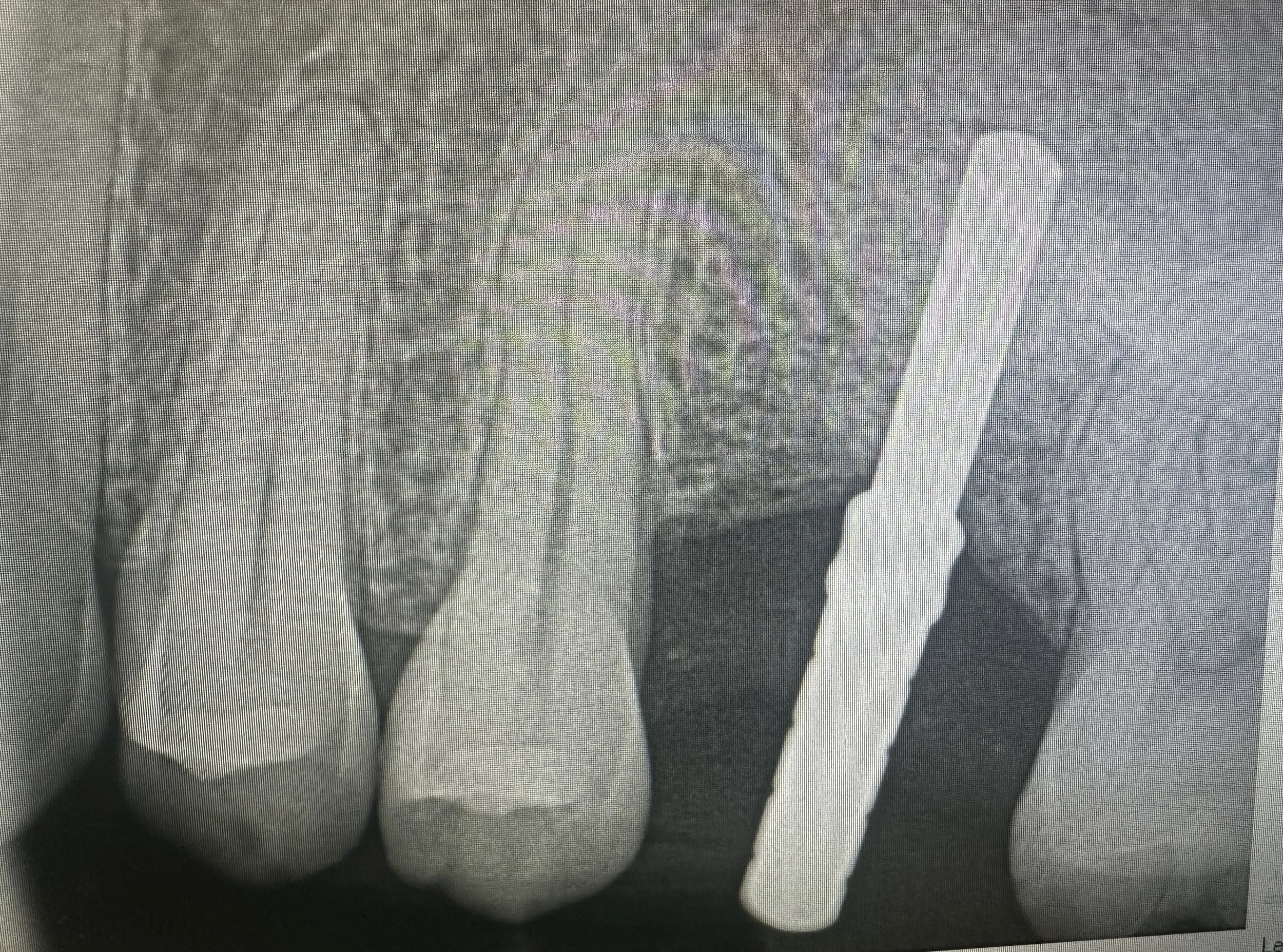 For professional reference only. All cases are anonymized and shared with patient confidentiality strictly maintained.