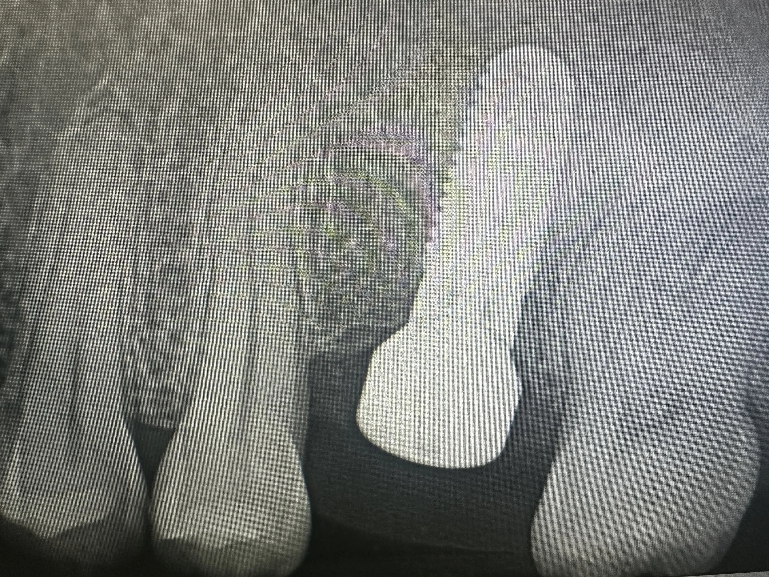 For professional reference only. All cases are anonymized and shared with patient confidentiality strictly maintained.
